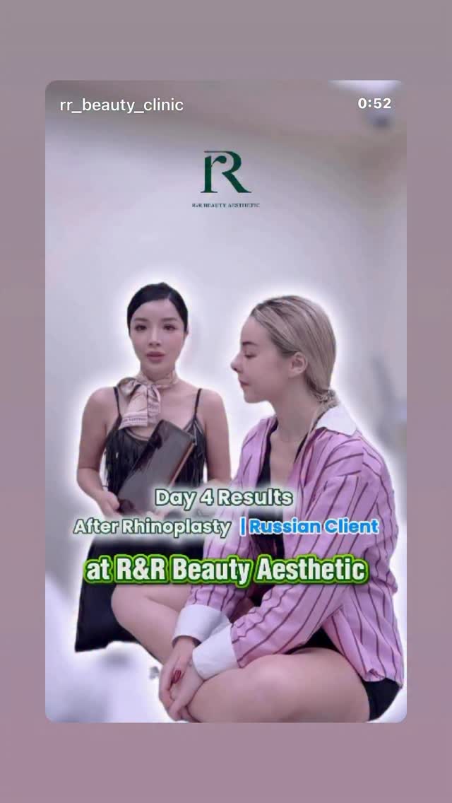 Day 4 rhinoplasty for beautiful girl #fatremoval #plasticsurgery #rhinoplasty #rhinoplastybeforeandafter