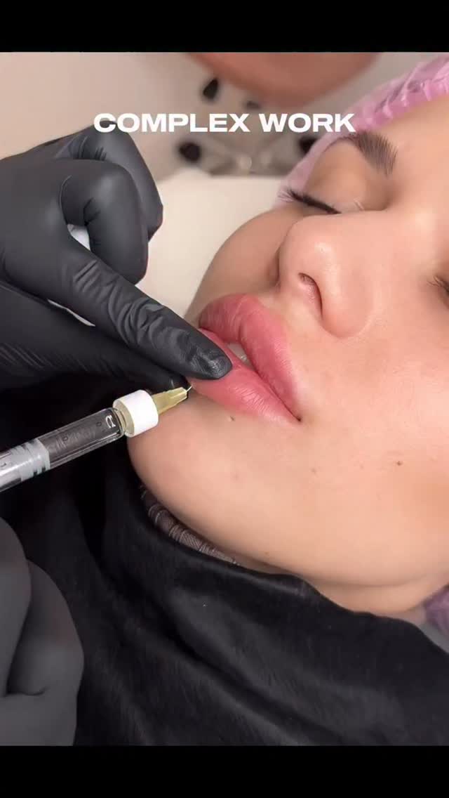 Lip and Chin Filler treatment at R&R Beauty Clinic
#chinfillers #lipfiler