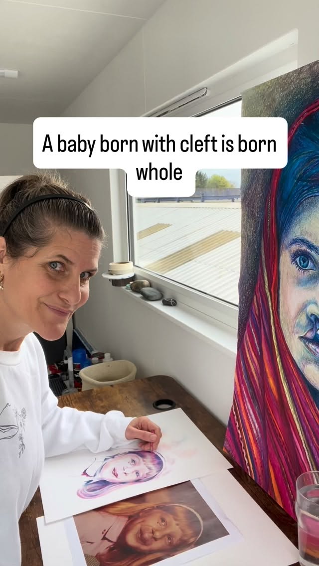 My art exists because people born with a cleft deserve to be seen in their wholeness, not as a before-and-after, not as a diagnosis and certainly not through a purely medical lens.
Wouldn’t you agree?
Comment ‘whole’ for details on how you can honour yours or your child’s beautiful face ❤️
#cleftfamily #cleftart #cleftbaby
❤️