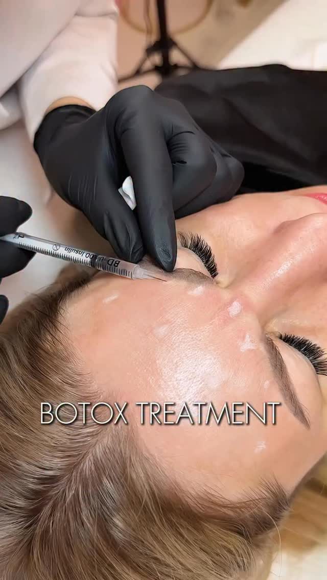 Botox Treatments
✔ Reduce and soften facial wrinkles
✔ Smooth under-eye wrinkles and fine lines
✔ Relax frown lines between the eyebrows (glabellar lines)
✔ Create a subtle eyebrow lift for a more youthful appearance
#botoxforehead #botoxhairtreatment #botox