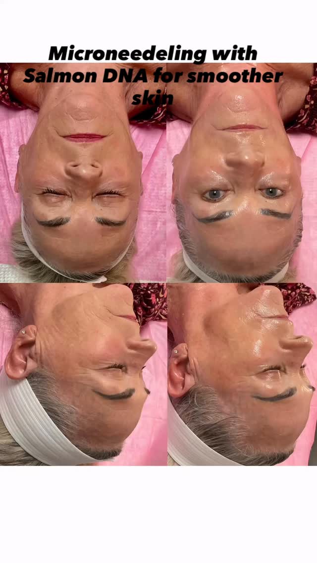 #capricebeautybar #sarasotaflorida #sarasotahifu #medspa #skinptoblems
Capricebeautybar.com