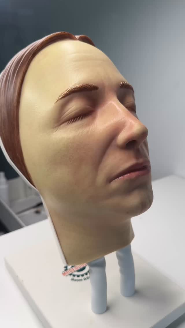 This isn’t always about ageing… sometimes it’s a malar fat pad split.
Using carefully placed dermal filler, we can restore support, soften the transition between the lower eyelid and cheek, and create a smoother, more refreshed appearance without looking overfilled.
✨ Restores midface volume
✨ Softens tired-looking shadows
✨ Supports facial structure
✨ Natural, balanced results
The best aesthetic treatments don’t change your face — they restore what has been lost.
📍Liverpool
📩 DM “CHEEKS” to book your consultation.