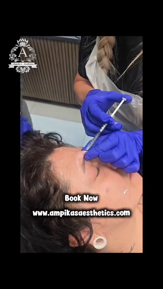 Benefits of Anti Wrinkle treatment ♥️♥️
Anti-wrinkle treatments are used to temporarily relax specific facial muscles that contribute to expression lines.
Potential Benefits
Reduces the appearance of wrinkles such as forehead lines, frown lines (between the eyebrows), and crow's feet.
Prevents deeper wrinkle formation by limiting repetitive muscle movements that can etch lines into the skin over time.
Creates a smoother, more refreshed appearance while maintaining a natural look when performed appropriately.
Quick treatment—appointments often take 10–20 minutes.
Minimal downtime—most people can return to normal activities shortly afterward.
Temporary and adjustable—effects typically last about 3–4 months, allowing future adjustments.
Can be used preventatively in some individuals who are beginning to develop expression lines.
#ampikasaesthetics#antiwrinkletreatment#aestheticstrainingcourses
