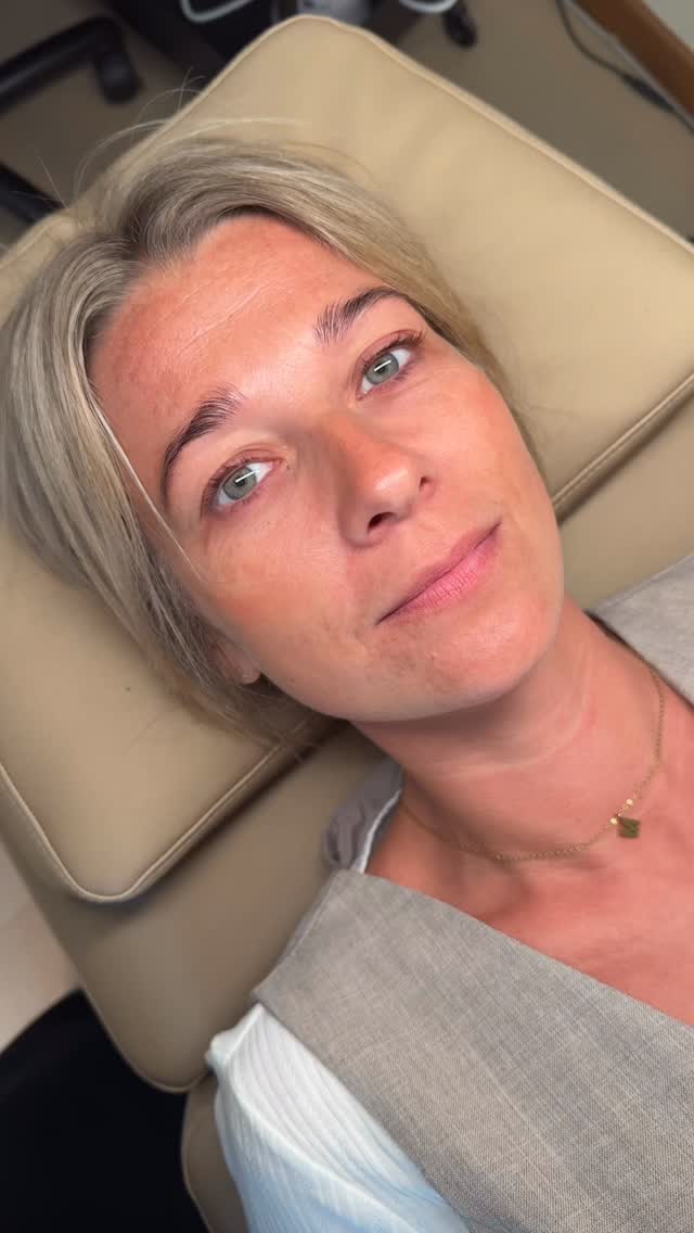 🔥 Lashlift og browlift med farve og hybridtint!
Fristet? 🤤
Der er ledige tider til dig..
Mandag d. 15/6 kl. 9:40 / 11:10 / 13:00 / 14:00
Tirsdag d. 16/6 kl. 9:00 / 13:00 / 18:30
Onsdag d. 17/6 kl. 15:45
Book dem via link i bio, eller smid os en DM! 🫰🏼
Har du spørgsmål? Tøv aldrig med at skrive. ❤️
#lajoliedk #heledig