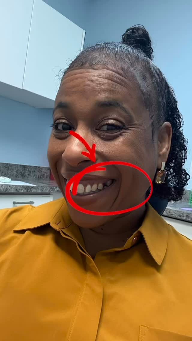 Finally getting my side tooth together. I’m so tired of all@of us losing to the same damn side tooth I swear it’s gotta be the fluoride in the tap water cause ain’t no way. This lil year trying to give me hell but I walked through fire with bare feet my entire life so it’s all I know, so it’s business as usual at this point.
