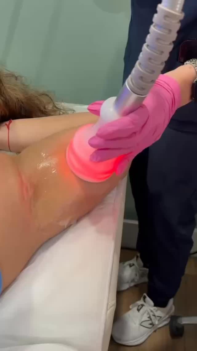 Those stubborn arms? We know them too well 💪✨
Cryosculpting helps target pockets of fat that don’t always respond to diet and exercise alone, creating a more sculpted, defined appearance over time.
A little more contour.
A little more confidence.
A lot less frustration.
Because feeling good in sleeveless season hits different ☀️
📲 Ready to start your transformation? DM me “CRYO” and let’s build your plan.
#CryoSculpting #ArmContouring #BodyContouringNYC #medspanyc