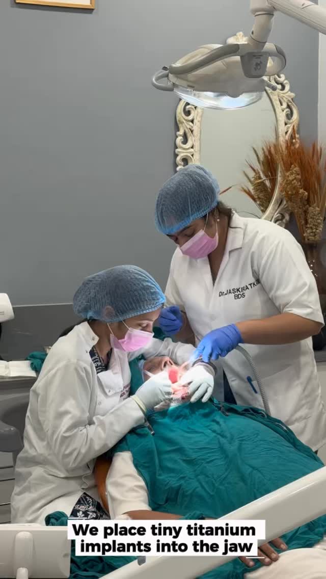 Say goodbye to slipping dentures! 🛑✨
Implant-retained dentures snap securely into place, giving you the confidence to eat, laugh, and smile without worrying about messy adhesives or accidental slips.
Here’s why patients love them:
✔️ Superior stability & comfort
✔️ Helps preserve jawbone health
✔️ No more palate coverage = better food taste!
Ready to upgrade your smile? Contact us to book appointment today ✨
#ImplantRetainedDentures #DentalImplants #SmileMakeover #cosmeticdentistry