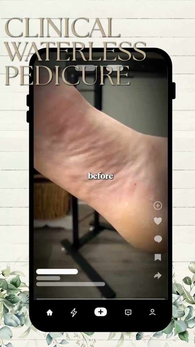 Problematic foot concerns rarely improve with pedicures alone. 💚
This guest experiences hyperhidrosis, and we began seeing significant improvement in his peeling after switching to waterless pedicures and adding a foot antiperspirant to his home-care routine.
Professional care + the right home care = a team effort toward healthier feet. 👣✨
#AdvancedFootCare #WaterlessPedicure #HyperhidrosisCare #HealthyFeet #CertifiedMasterPedicurist