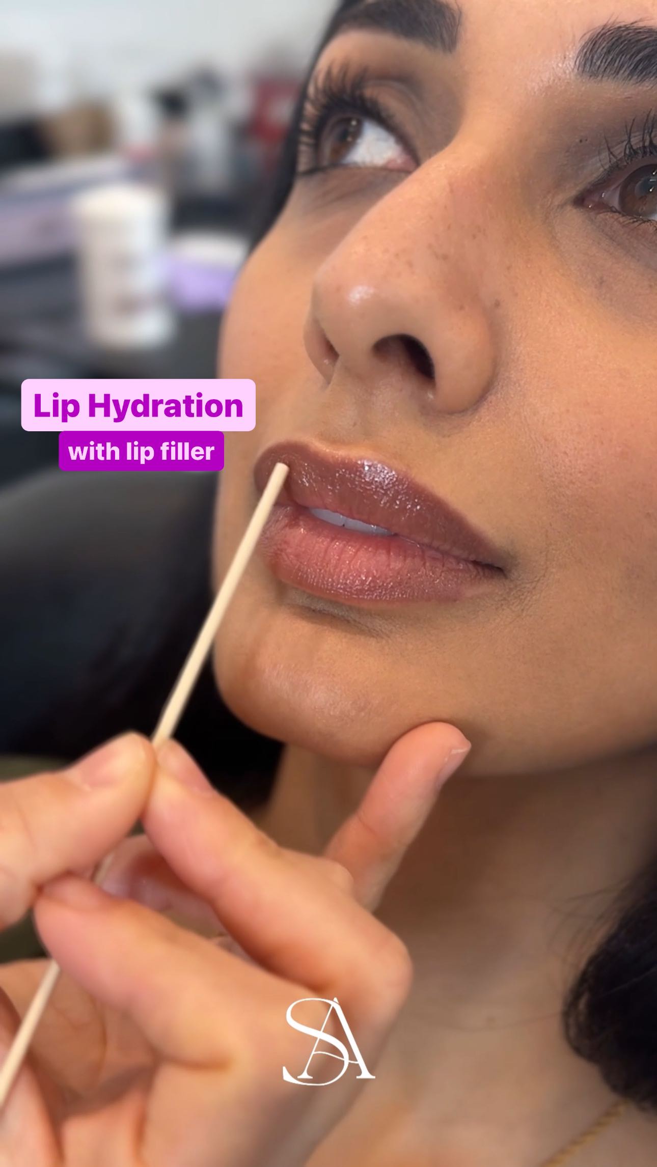 💋Maintaining Naturally Beautiful Lips with Subtle Hydration
Today we’re performing a subtle lip enhancement procedure on a patient with naturally beautiful lips. The goal is to provide internal hydration and a thin layer of product to maintain the lips’ plump, hydrated appearance.
💕Send me a DM to book or use the link in our bio
#lips #lipgloss #lipstick #pout #lipfiller