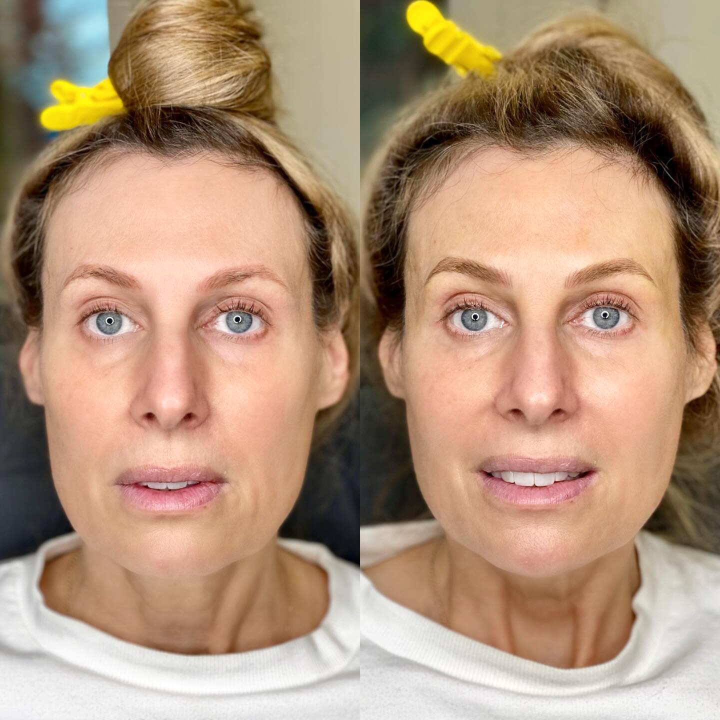 Who doesn’t love a good before & after shot?! 😍🙌
.
We updated and covered up her previous, faded brow work (done by another artist)
.
.
.
.
.
.
.
.
.
.
.
.
.
.
.
.
#northvan #westvan #vancouverpmu #hibrowink #lonsdaleave #lowerlonsdale #northvanmoms #westvanmoms #northvancouverartist #northvanlashes #northvanbeauty #westvanlife