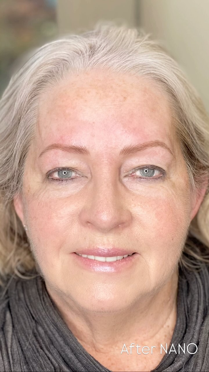 All about that NANO transformation 💥
.
.
.
.
.
.
.
.
.
.
.
.
.
#lowerlonsdale #northvanmoms #westvanmoms #northvanlife #vancouverpmu #northvanbeauty #westvancouver #vancouverpmu #northvan #northvancouver