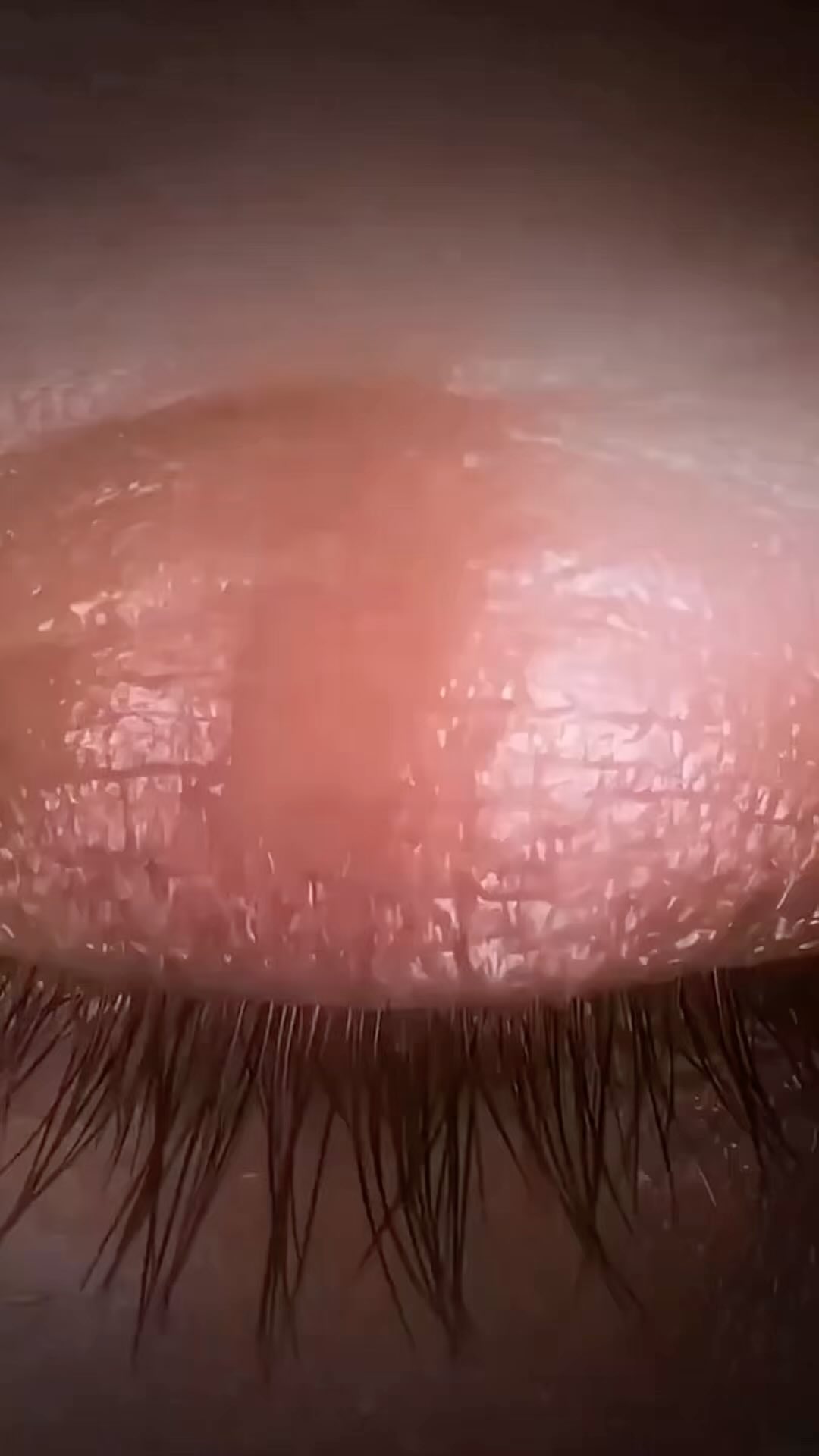 #globallimitlesssolutions