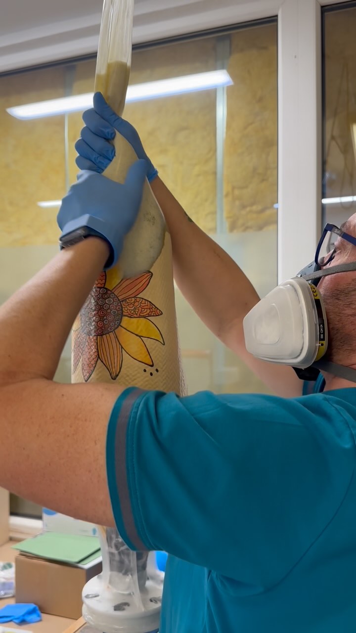 Herstellung einer Unterschenkelprothese für eine liebe Kundin, die sich das Design selbst ausgewählt hat (und wir haben alles daran gesetzt, es ihr genau so zu ermöglichen). Mit Glitzer ✨😍
🇬🇧 making of: below knee prosthesis. Nice design which was chosen by the customer herself. With glitter ✨😍
•
•
#orthopädietechnik #oandp #unterschenkelprothese #prosthesis #belowkneeprosthesis #prothese #prosthetics #beinprothese #prostheticleg #amputiert #amputee #amputeelife #lifestylemedicine #handwerk #handmade #handcrafted #handwerksstolz #handarbeit #immerweiter #lustaufhandwerk #custommade #meinhandwerkhilft