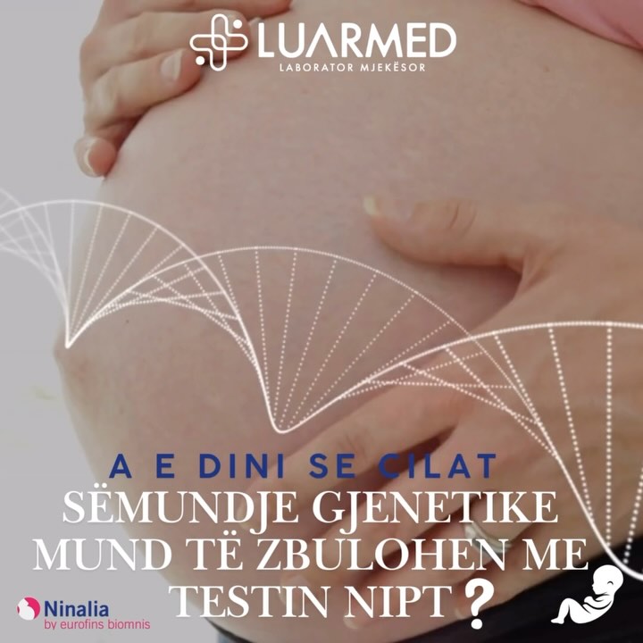 ▫️Sindroma Down (Trisomia 21): Është sëmundja kromozomale më e zakonshme që shkaktohet nga 3 kopje të kromozomit në vend të 2. Kjo mund të çojë në probleme të zhvillimit mendor dhe fizik.
▫️Sindroma Edwards (Trisomia 18): Të kesh 3 kopje të kromozomit në vend të 2 shkakton sindromën Edwards. Është një sëmundje kërcënuese për jetën që shoqërohet me çrregullime të rënda zhvillimore dhe zakonisht shfaqet menjëherë pas lindjes.
▫️Sindroma Patau (Trisomia 13): Është një anomali e rrallë kromozomale në të cilën ka 3 kopje në vend të 2 në kromozom. Është një sëmundje e shoqëruar me anomali të rënda të zemrës, veshkave dhe trurit.
Për rezervime dhe informacione rreth testit Nipt Ninalia kontaktoni në:
📲0675000410
Adresa:📍Rruga “Andon Zako Çajupi”, përballë postës nr.8 (Zayed Bussiness Center), Kati 2
🌐www.luarmed.com
Ju mirëpresim!