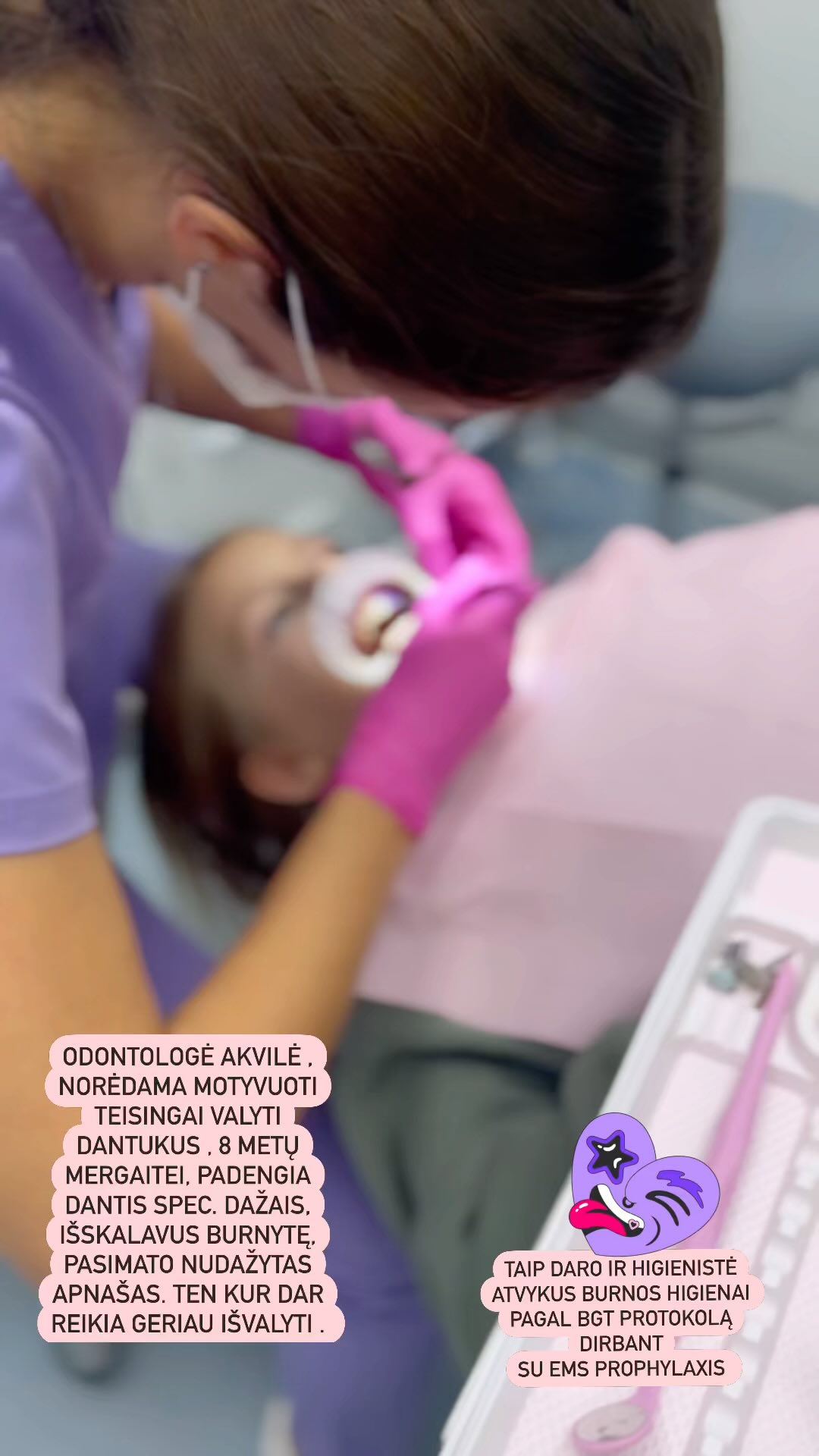 Apžiūra vaikui.
Odontologė Akvilė, kruopščiai ir švelniai apžiūrėjo dantukus, paprašė išsivalyti pačiai mergaitei, tada padengė dantukus dažais , išskalavus burnytę, matėsi vietos, kur liko neišvalyta, tuomet parodė kaip reikia teisingai išvalyti, naudoti dantų siūlą. Nupoliravo šepetėliu dantukus.
#baltaakvarele #dantugydymasklaipedoje #odontologeklaipedoje #vaikudantugydymasklaipedoje #odontologijosklinikaklaipėdoje