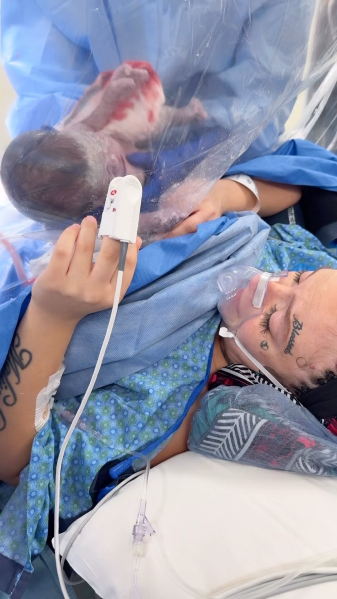 Yes, you CAN have skin to skin experience with your newborn immediately after a c-section.✨
This mom’s joy and excitement to hold her little one brought me to tears 😭.
I was so grateful to be able to comfort and support this client through her c-section.
A calm spirit and heart allowed for a peaceful birth. ❤️
#doula #doulalife #doulasupport #birthdoula #csection #firstcry #birth #birthday #baby #littleone #tenfingerstentoes❤️ #recovery #recoverytime #peace #calm #tranquility #comfort