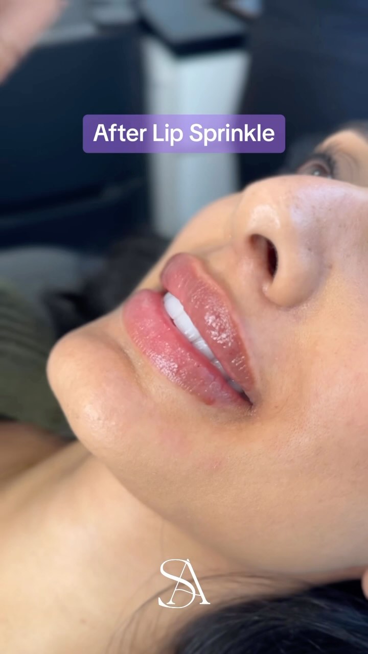 👄 Subtle. Plump. Natural. ✨
#lips #plump #lipgloss #lipfiller #pout #plumplips
