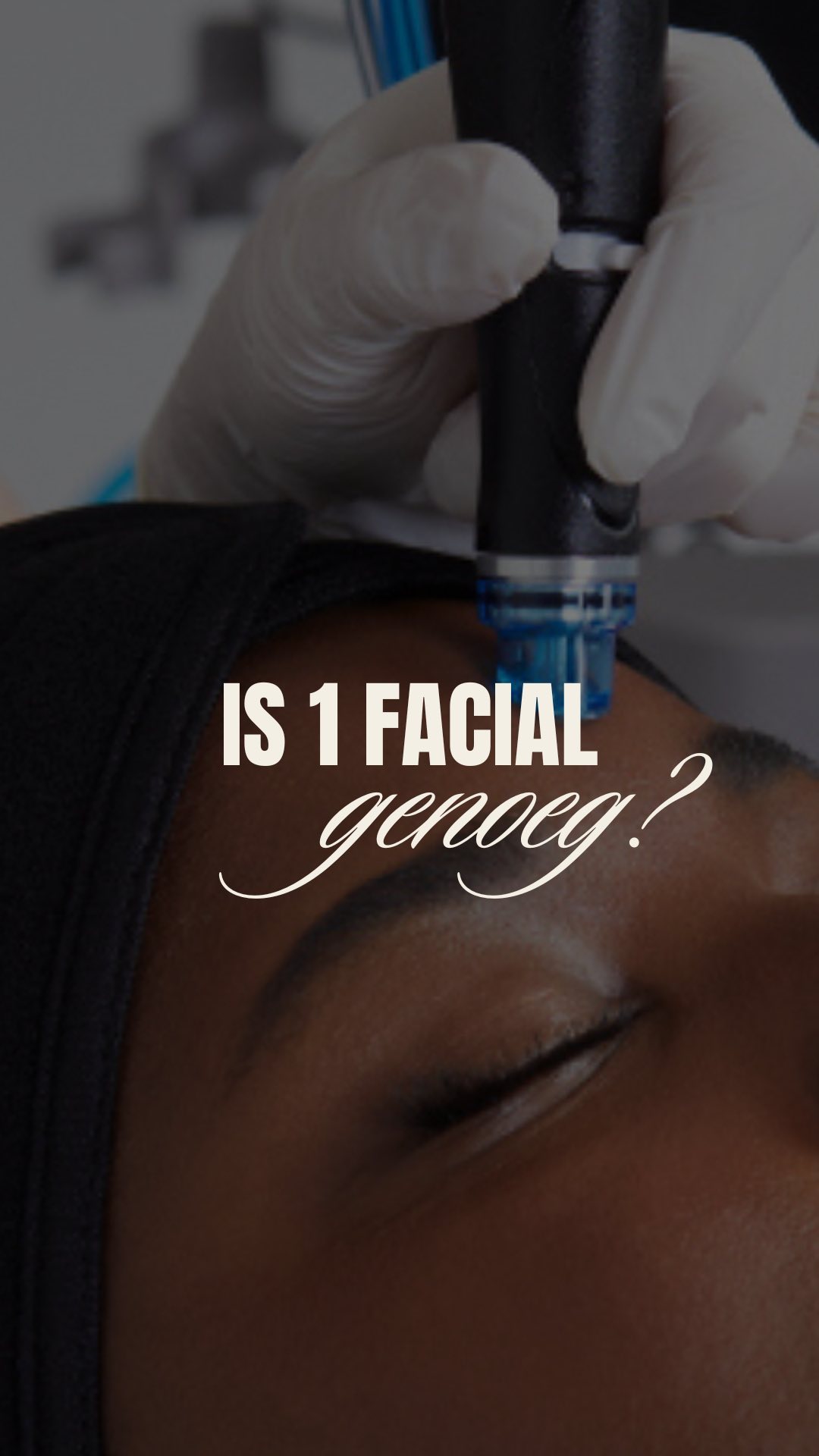 Is 1 Facial Genoeg? 🤔Niet Helemaal…
Net zoals je niet met één sportsessie je droomlichaam krijgt, geldt hetzelfde voor je huid. Je huid is een levend orgaan, constant in beweging, en het heeft tijd nodig om te herstellen, versterken en stralen. Échte skin goals kosten aandacht en consistentie.
Het is verleidelijk om te denken dat één behandeling alles oplost. En ja, na één facial zie je vaak al verschil—je huid voelt frisser, zachter, en ziet er beter uit. Maar échte, blijvende resultaten? Die vragen meerdere behandelingen.
Een kuur van minimaal 3 facials helpt jouw huid écht transformeren. Het geeft je huid de boost die het nodig heeft om sterker, gezonder en stralender te worden. En wist je dat een kuur vaak voordeliger is? Slim én resultaatgericht.
Facials zijn geen luxe. Het is jouw investering in jezelf, in een huid waar jij je elke dag goed bij voelt. Begin vandaag met jouw glow journey. Jouw huid verdient het! ✨
Stuur ons een bericht met “INFO” voor meer details of om direct te boeken.
- Alles wat je nodig hebt, vind je via de 🔗 in onze bio.
Boek online een afspraak: www.thehagueclinic.nl
📞 Bel: 085 060 74 77
📧 E-mail: info@thehagueclinic.nl
LIKE, SAVE & FOLLOW als jij klaar bent voor jouw huidtransformatie.
🤍 @thehagueclinic