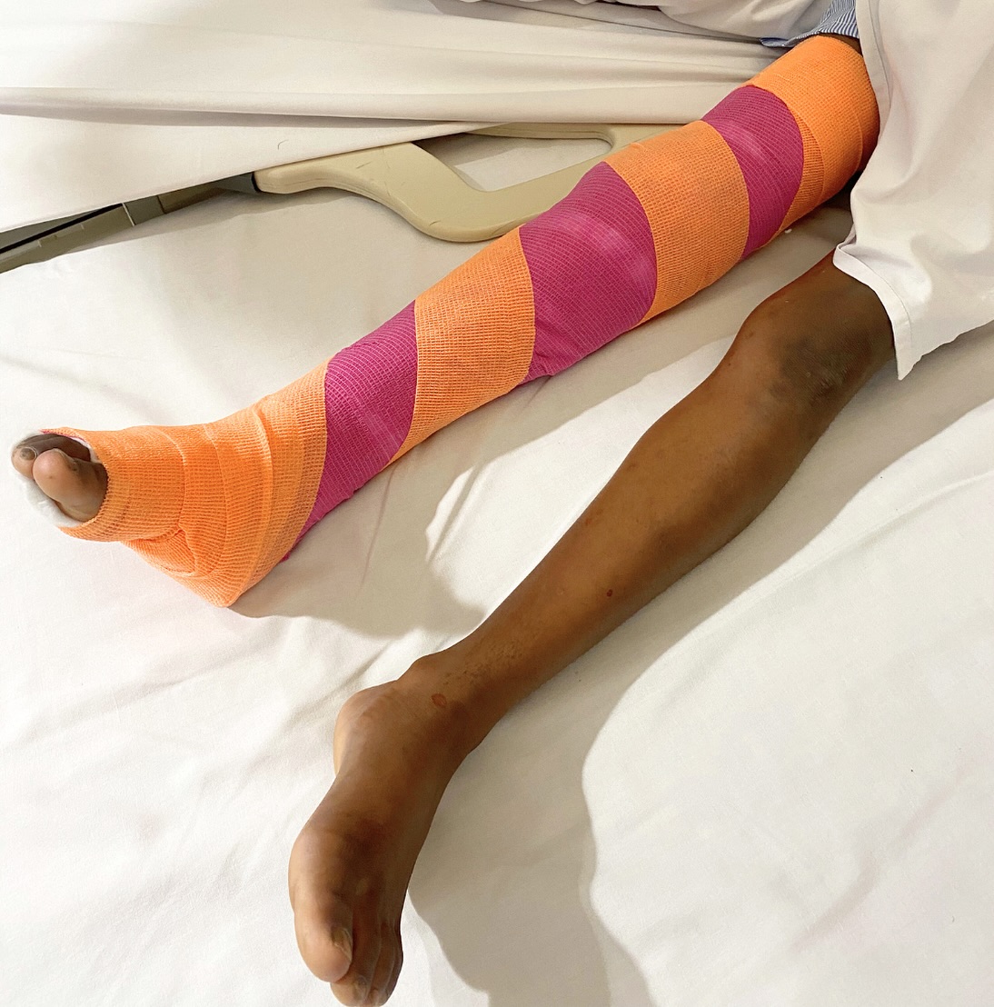 DAR ES SALAAM — DEC 2024. It’s been an incredible week for women, girls, local surgeons, and surgical trainees! STAY TUNED to learn more about our incredible collaboration with @agakhanhospitaldsm and inspiring patient outcomes. 🤍 #Gratitude #GlobalHealth #Impact
🤍🤍🤍
#RWI #ReconstructingWomenInternational
@reconstructingwomenintl @kavirangmd @323shell @martinagreminger
#reconstructingwomeninternational #donate #womenhelpingwomen #help #nonprofit #nonprofitorganization
@reconstructingwomenintl @drtonizhong @nvlmedicalaesthetics @dr.neuhannlorenzplasticsurgery
@dr.sarah_isenburg @katharina_isenburg @caitg.kwok @lhelliwellmd @pursuitofhapp.ines @maryanneog @rita_joana @mariechristinematthieu @agakhanhospitaldsm @just_geofrey
@emilylaurenclark @mcoriddi @alexeshazenmd @drtraceyathompson