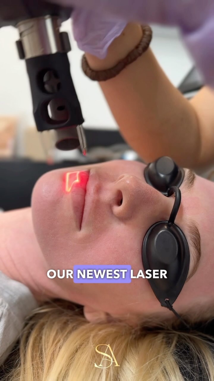 Introducing our new Tetra PRO laser device from Cartessa, which offers a highly versatile CoolPeel CO2 laser treatment. This laser can address a variety of skin concerns like fine lines, pores, texture, acne, and scars, with limited downtime.
The device is also suitable for a wider range of skin types compared to traditional CO2 lasers.
💕Interested in learning more? Use the link in our bio to schedule a consultation.
#laser #co2 #skin #skincare #koreanskin #acnescars #acne