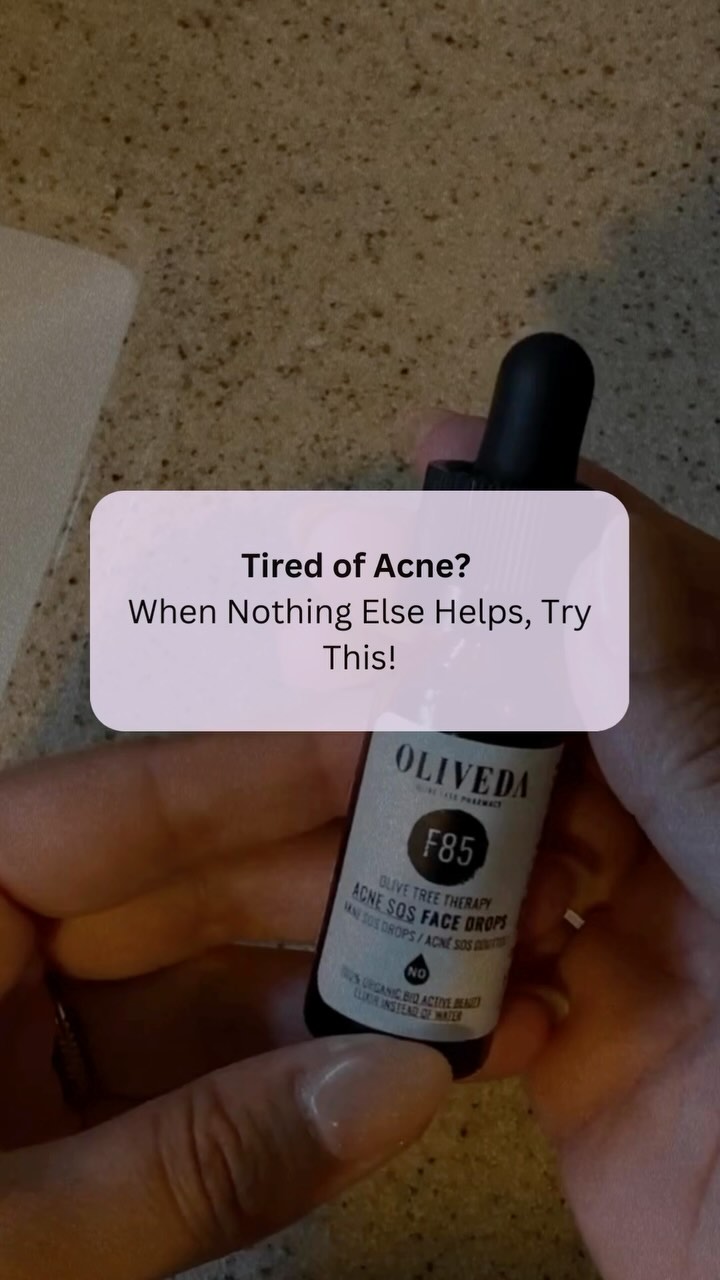 ✨ Tired of battling acne with empty promises? I’ve been there. As I taper off Spiralactone this is how I’m gonna keep my skin clear naturally! 💚
🌿 Oleuropein (olive leaf extract) soothes irritation and reduces redness with its powerful antioxidant and anti-inflammatory properties.
🌟 Potassium Azeloyl Diglycinate targets acne-causing bacteria and balances oil production.
💧 Azelaic Acid unclogs pores, reduces inflammation, and fades stubborn post-acne marks for smoother, even-toned skin.
🌱 Saw Palmetto Extract regulates sebum to keep breakouts in check.
✨ Juniper Berry & Sunflower Seed Oil hydrate without clogging pores—a game-changer for acne-prone skin!
📢 Ready to heal your skin naturally? Let these ingredients work their magic. 🌿
.
.
.
.
.
#acnesolution #acnecommunity #hormonalacne #acnetips #plantbasedskincare #clearskinjourney #olivetreepeople #glownaturally