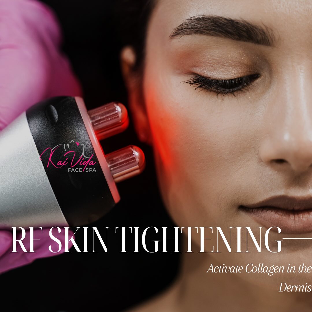 ✨ Tighten, Tone & Glow ✨
Say hello to firmer, younger-looking skin with RF Skin Tightening at Kai Vida Face Spa! This advanced treatment stimulates collagen production deep within the dermis, helping to smooth wrinkles, lift sagging skin, and restore your natural radiance. 💆♀️
📍 Ready to feel the difference? Book your session today and activate your glow from within!
💖 Where your face is the focus, always.
#KaiVidaFaceSpa #SkinTightening #RFSkinTightening #GlowingSkin #CollagenBoost #FacialRejuvenation #SpaDayVibes #YouthfulSkin #AntiAgingTreatments #SelfCareEssentials #facialsnearme