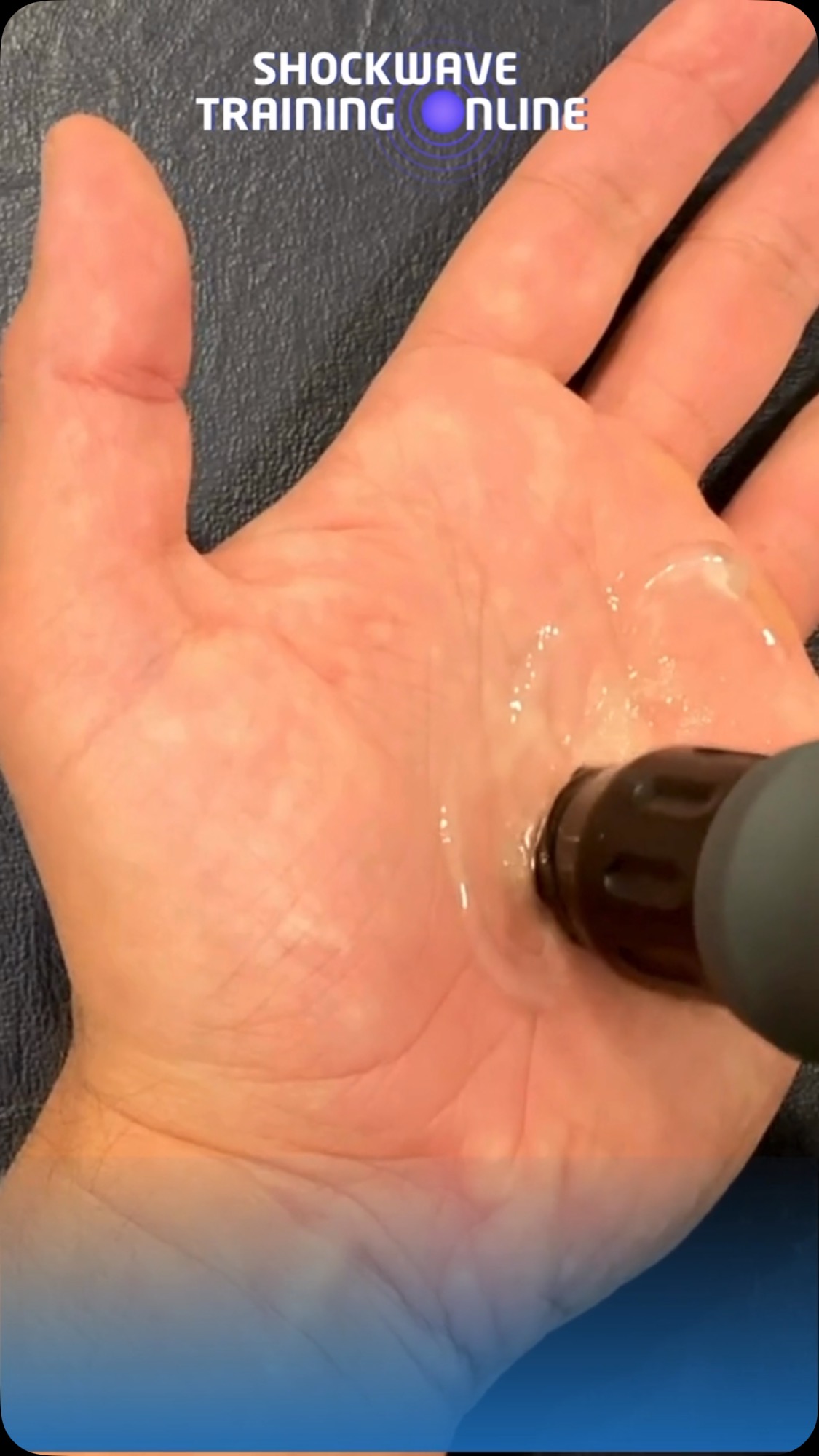 Hand contractures can severely limit a patient’s mobility and quality of life, but shockwave therapy offers a promising solution. This non-invasive treatment can help reduce pain, improve range of motion, and support the healing process for those suffering from contractures. 💥
In our online course, we’ll guide you on how to apply shockwave therapy safely and effectively to treat hand contractures and other soft tissue conditions. Our course is designed to be quick, simple, and practical, making it easy for healthcare professionals to integrate into their clinical practice. ✅
Ready to enhance your treatment approach? Visit www.shockwavetrainingonline.com to learn more and enroll today!
#ShockwaveTherapy #HandContractures #PainManagement #PhysicalTherapy #HealthcareProfessionals #InjuryRecovery #MusculoskeletalHealth #ContractureTreatment #ShockwaveTraining #TherapeuticInnovation #EvidenceBased #QuickAndSimple #PatientCare #Rehabilitation #ContinuingEducation #NonInvasiveTherapy #HealthTech