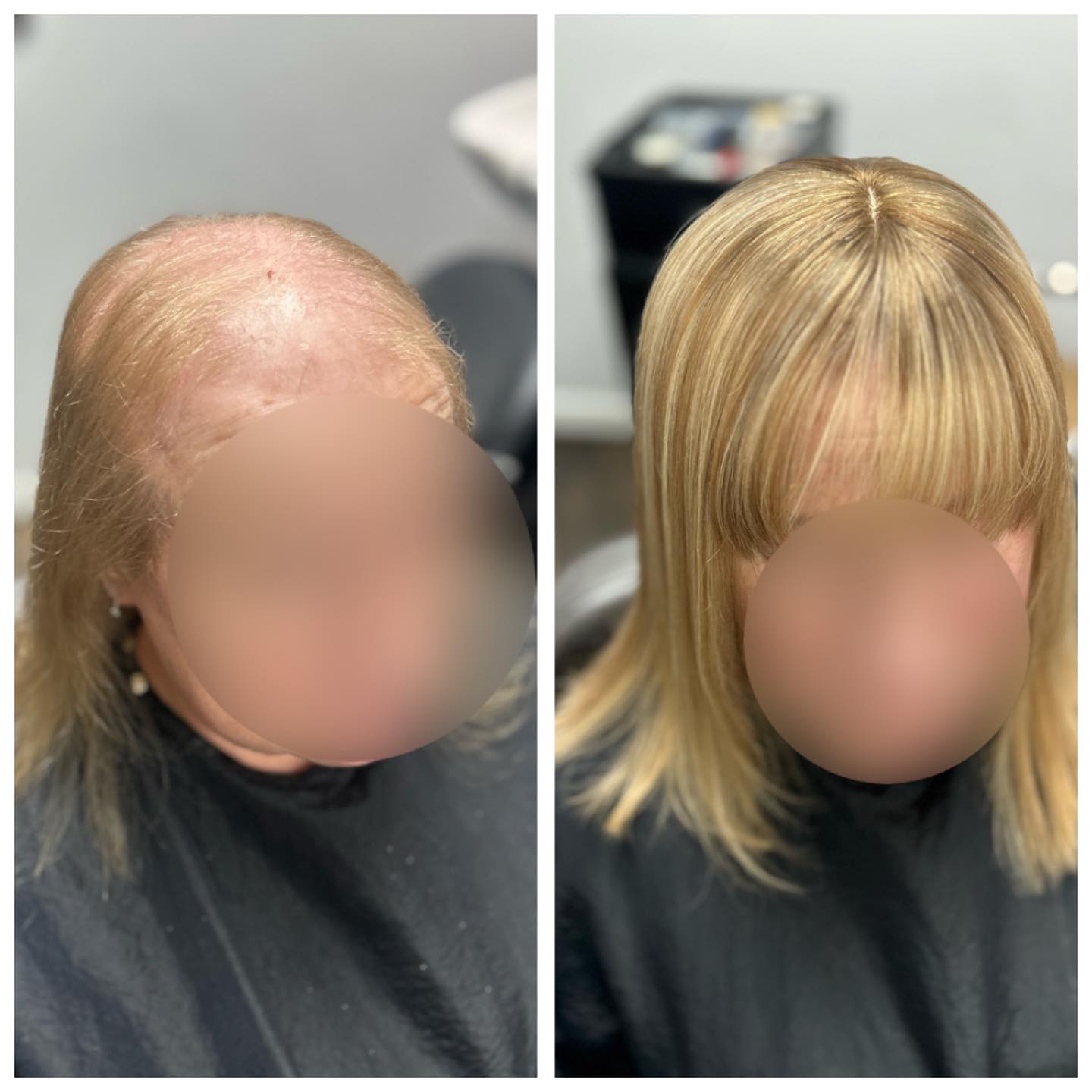 ✨ When you come to see me for a chat about options for hair integration, I will tell you all about the maintenance, we will discuss colour options and lifespan of the systems, the average life span is around 2 -2.5 years. This lovely lady broke the record her last system lasted 5 years!!!
So time for a new one today. Check out this incredible before and after.
Curious about lace integration systems? Get in touch now.
#LaceIntegration #HairTransformation #BeautyGoals