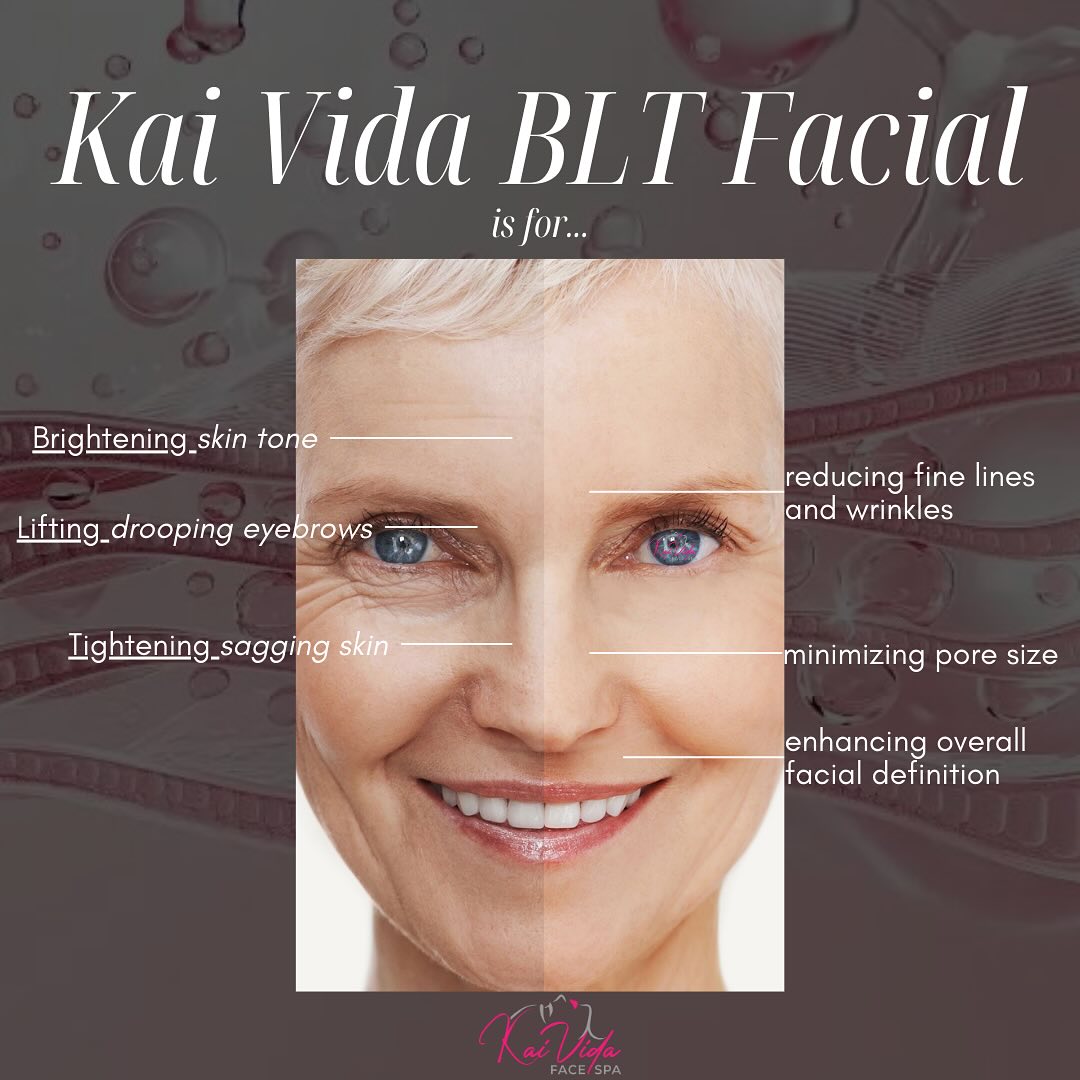 🌟 Brighten. Lift. Tighten. 🌟
The Kai Vida BLT Facial is your all-in-one solution to youthful, radiant skin! This advanced treatment targets:
✨ Brightening uneven skin tone
✨ Lifting drooping brows & features
✨ Tightening sagging skin
Say goodbye to fine lines, wrinkles, and large pores, and hello to enhanced facial definition. Ready to see the difference? Your skin transformation is just a booking away!
💖 Kai Vida Face Spa – Where your face is the focus.
#KaiVidaBLTFacial #tighteningfacial #antiagingfacial #radiantskin #youthfulglow #facialrejuvenation #luxuryspa #glowingskingoals #facialnearme #spanearme #chesterfacials #morriscountynj