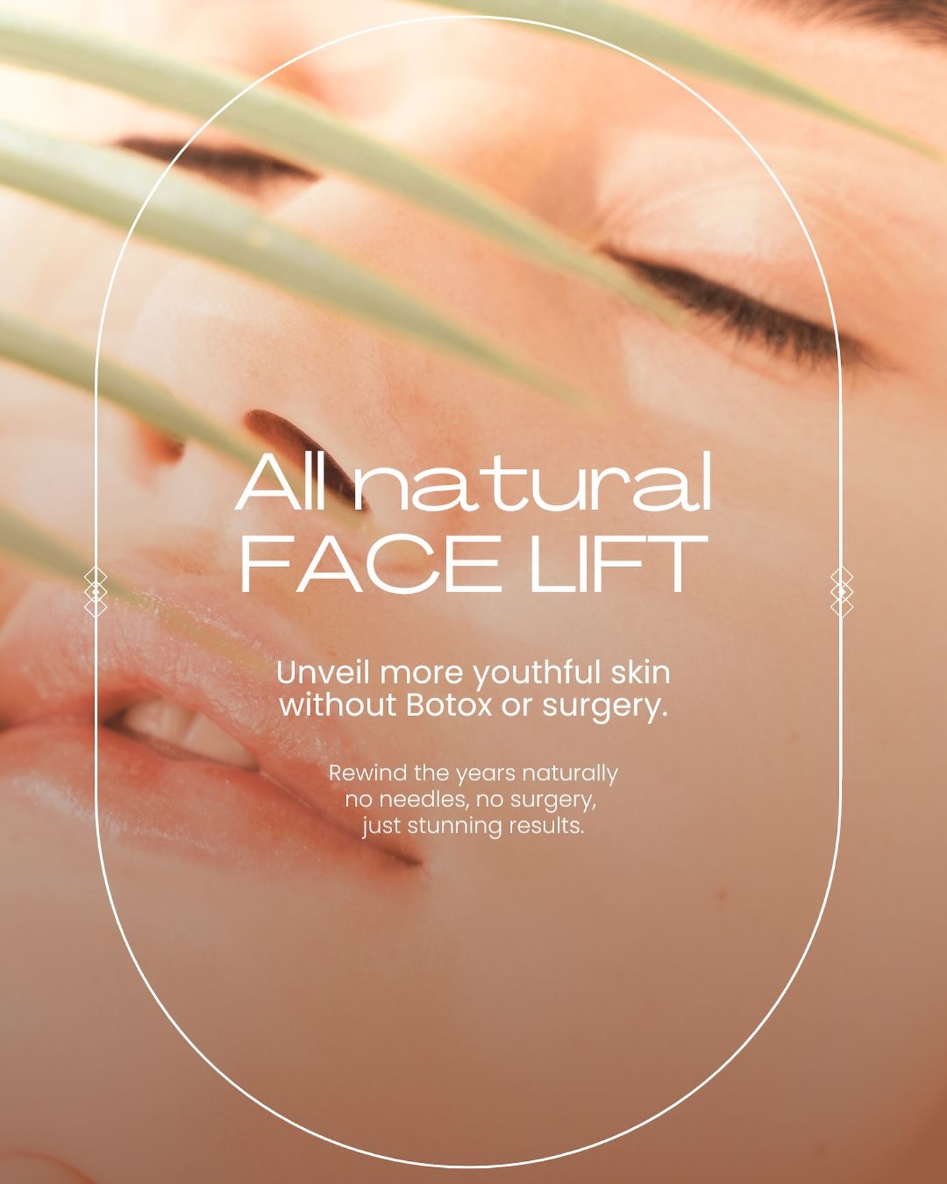 Looking for a natural way to lift, tighten, and rejuvenate your skin without fillers, toxins, or surgery? Plasma Fibroblast is the revolutionary treatment you’ve been waiting for! Introducing the all natural treatment PLASMA FIBROBLAST!!!
Why Choose Plasma Fibroblast?
• Achieve a natural facelift without going under the knife.
• Results last longer than Botox and look beautifully natural.
• Avoid the risks of surgery or harsh chemicals—no fillers or nasties involved.
• Enjoy a quicker recovery and a more affordable solution compared to surgery or Botox.
Plasma Fibroblast offers surgery-like results without the dangers, costs, or artificial look. It’s time to turn back the clock and feel confident in your own skin!
💌 DM us to book your consultation and take the first step toward naturally youthful skin. Your glow-up is waiting!