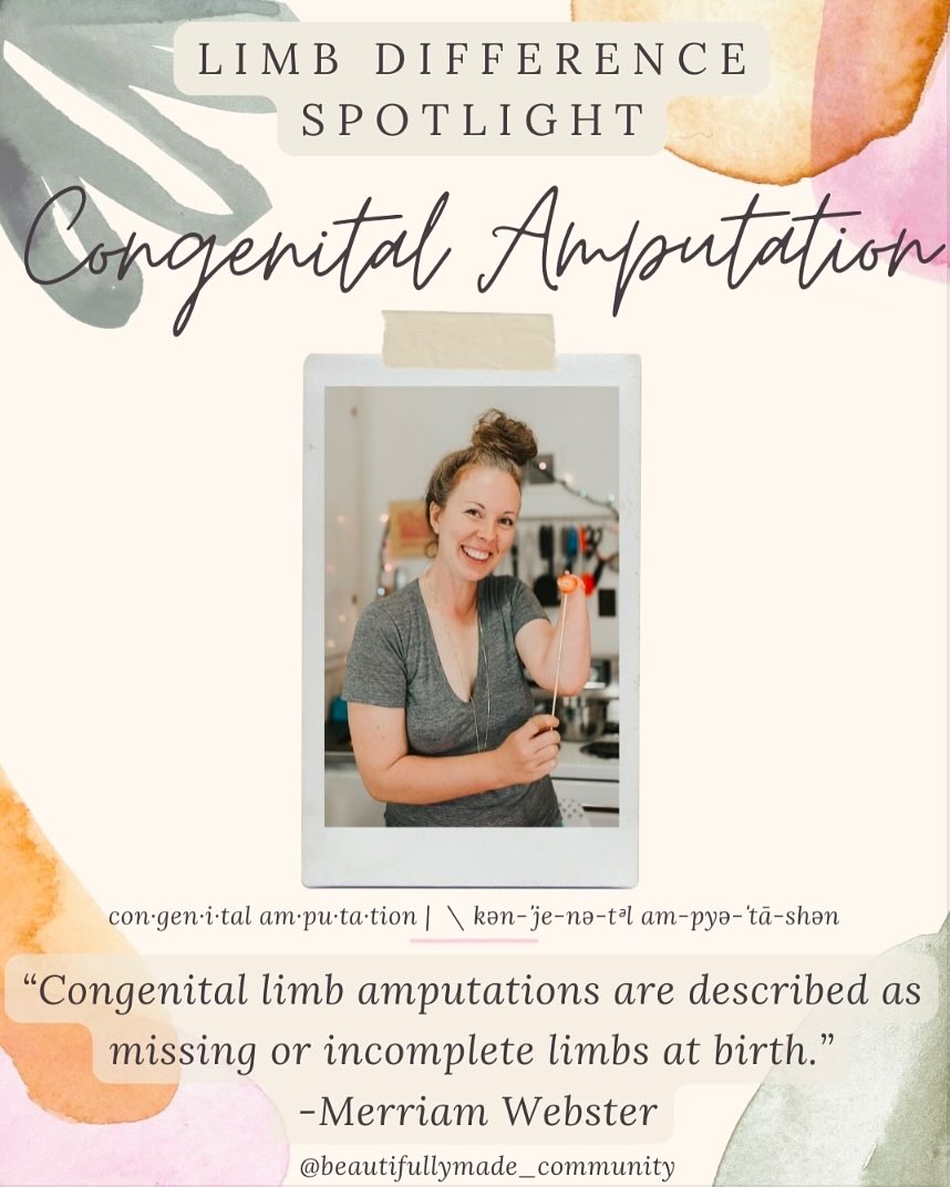 ✨Limb Difference Spotlight✨
Congenital amputation is a condition where a person is born without a limb or portion of a limb. About 1 in 2,000 babies are born with congenital amputation each year.
The condition is often caused by amniotic band syndrome, which occurs when a free floating piece of amniotic sac tissue becomes entangled with a baby’s developing limb, cutting-off the blood supply and halting development. Amnion ruptures, a condition where the internal amniotic sac becomes separated from the outer portion, contributes to free-floating tissues. However, the exact causes of most cases cannot be exactly pinpointed.
Although congenital amputation does not usually hinder a person’s ability to adapt some people might consider prosthetics as a personal decision.
✨RESOURCES✨
▫️Facebook-
“The War Amps” (don’t let the name confuse you it is for children also!)
- https://www.facebook.com/TheWarAmps/
“Amputee Coalition”
- https://www.facebook.com/AmputeeCoalition/
▫️Instagram-
@stump_kitchen
@katelynjrichter
@mama.and.littlefish
@bayron777
@kathysol
@bridgetsalopek
@kpreyn
@mad4minnie
▫️Websites-
▫️https://globalgenes.org/disease/congenital-amputation/
▫️https://www.amputee-coalition.org/resources/amputations-in-childhood/
▫️https://www.merriam-webster.com/dictionary/congenital%20amputation
————————————————————————
If you have any other resources pertaining to Congenital Amputation a please feel free to leave yourself or another page in the comments. 👇
•
•
#beautifullymadecommunity
#congenitalamputation #luckyfinproject #beautifullymade #luckyfinsrock #tenfingersareoverrated #representationmatters #limbdifferenceawareness #luckyfin #disabilityawareness #awareness #education #representation #adapt #beautiful #educate #connect #inclusion #positivity #limbdifferencespotlight
