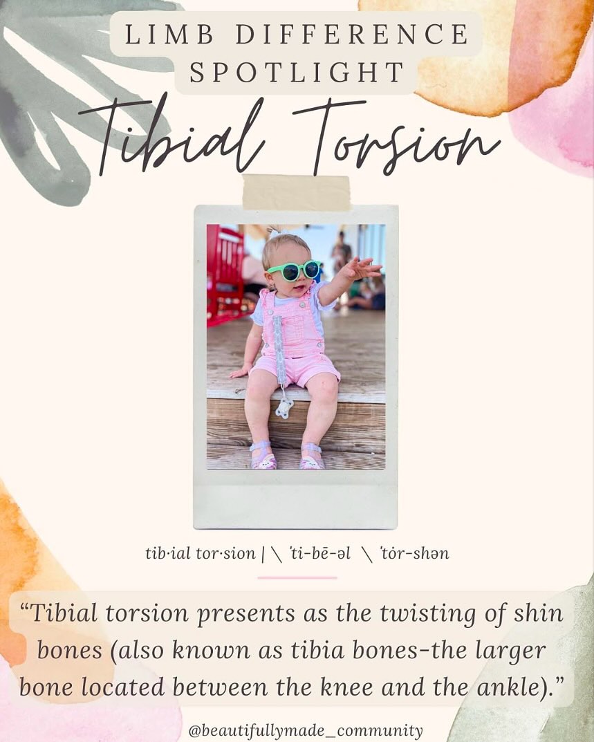 ✨Limb Difference Spotlight✨
Tibial Torsion
tib·i·al | \ ˈtib-ē-əl : of, relating to, or located near a tibia. \ tor·sion | \ ˈtȯr-shən : the twisting of a bodily organ or part on its own axis.
There are two types of tibial torsion: internal & external. Whether the toes point inward (intoeing) or outward (outtoeing), tibial torsion is a common cause of gait (manner of walking) differences. Other conditions that can cause intoeing include:
• femoral anteversion, the inward twisting of the thigh bone (femur)
• metatarsus adductus, a foot deformity that causes the front half of the foot to turn inward.
Almost all children with internal tibial torsion improve without treatment, usually by the time they turn 4.
Although tibial torsion is a limb difference that you’re born with, it is often unnoticeable until a child starts to walk. For many kids, one leg twists more noticeably than the other.
✨RESOURCES✨
▫️Facebook-
🔎 “Clubfoot support”
▫️Instagram-
▪️ @amandabee1103
▪️ blanc.beaute__
▫️Websites-
▪️ https://www.merriam-webster.com/medical/tibial
▪️ https://www.merriam-webster.com/dictionary/torsion
▪️ https://emedicine.medscape.com/article/1251352-overview
▪️ https://www.chop.edu/conditions-diseases/tibial-torsion
▪️ https://www.childrenshospital.org/conditions/tibial-torsion
————————————————————————————
If you have any other resources pertaining to Tibial Torsion please feel free to leave yourself or another page in the comments.
•
•
#beautifullymadecommunity #beautiful
#kindnessmatters #luckyfinproject #beautifullymade #luckyfinsrock #representationmatters #limbdifferenceawareness #luckyfin #disabilityawareness #awareness #education #representation #positivity #inclusion #connect #resources #differentisbeautiful
#strong #inclusiveeducation #tibialtorsion #lowerlimbdifference #limbdifferencespotlight