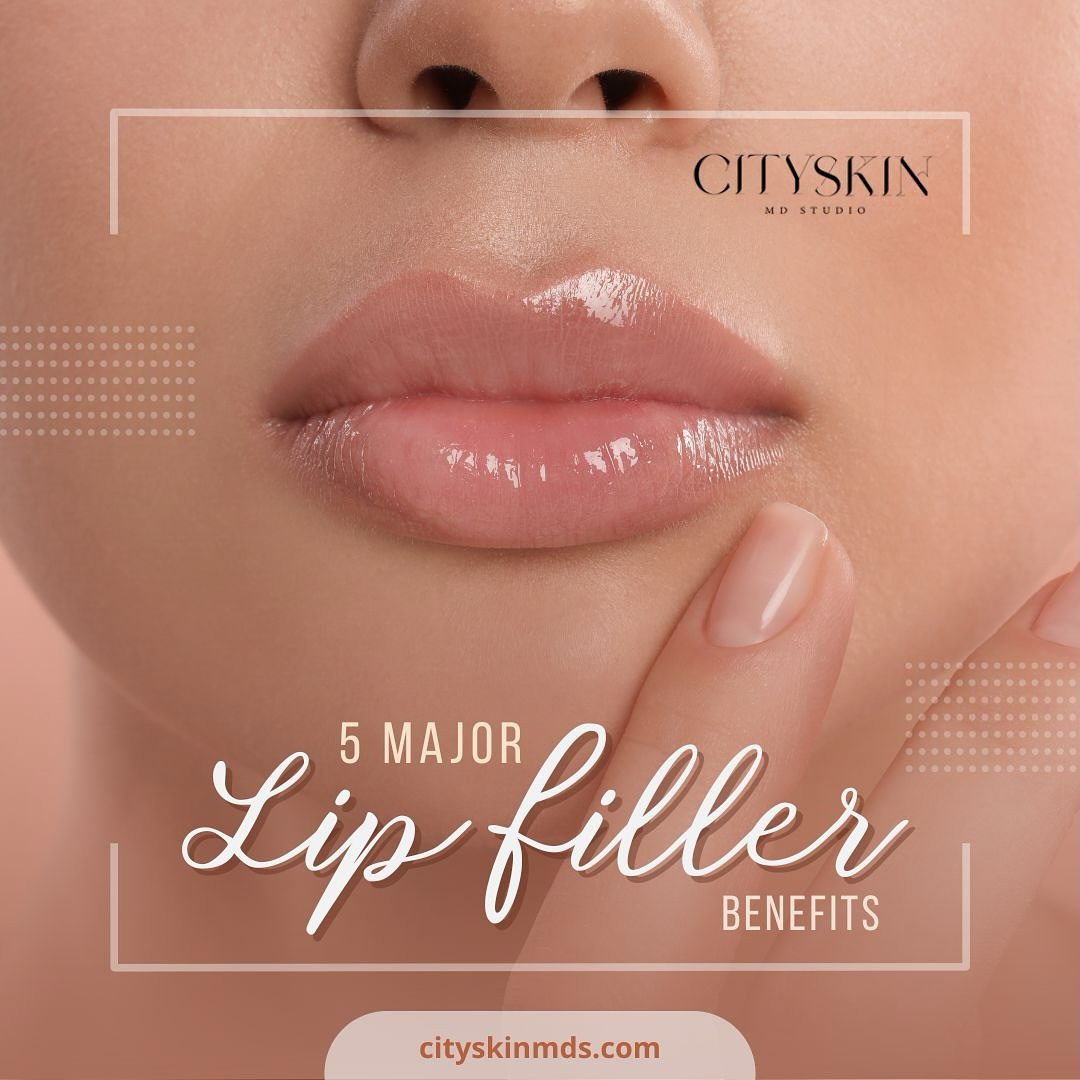 💋 Elevate your look with the perfect pout! Lip fillers are not just about volume—they offer so many benefits. Here are the 5 major perks:
1️⃣ Enhance natural shape & definition
2️⃣ Add youthful plumpness
3️⃣ Smooth out fine lines around the lips
4️⃣ Boost confidence with a personalized touch
5️⃣ Hydrate and rejuvenate your lips
Ready for your lip glow-up? Book your consultation today! 💖
#LipFiller #PlumpLips #AestheticGoals #BeautyEnhancement #NaturalResults #LipCare #LipGoals #ConfidenceBoost #GlowUp #HydratedLips #LipTreatment #AestheticMedicine #SelfCareJourney #NonSurgicalBeauty #CitySkinMD