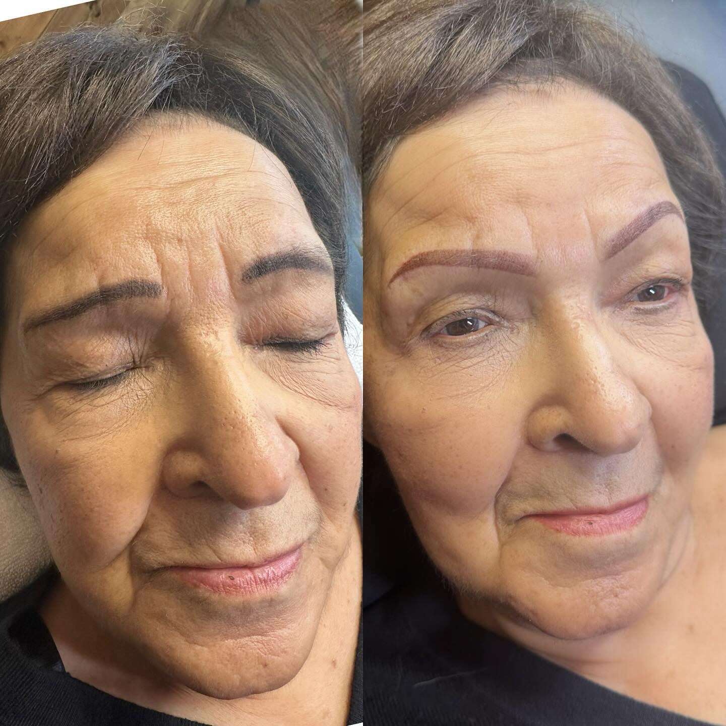 This was such an honour to give this beautiful 89 years young lady some new brows!! She had beautiful skin and yes these look reddish and that will fade more neutral as they heal! Fresh brows look severe but soften as they heal. What a treat to be able to fiver some brows for Christmas 🎄✨ #browtattoo #browsyyc #yycbrows #calgarybrows #eyebrowtattoo