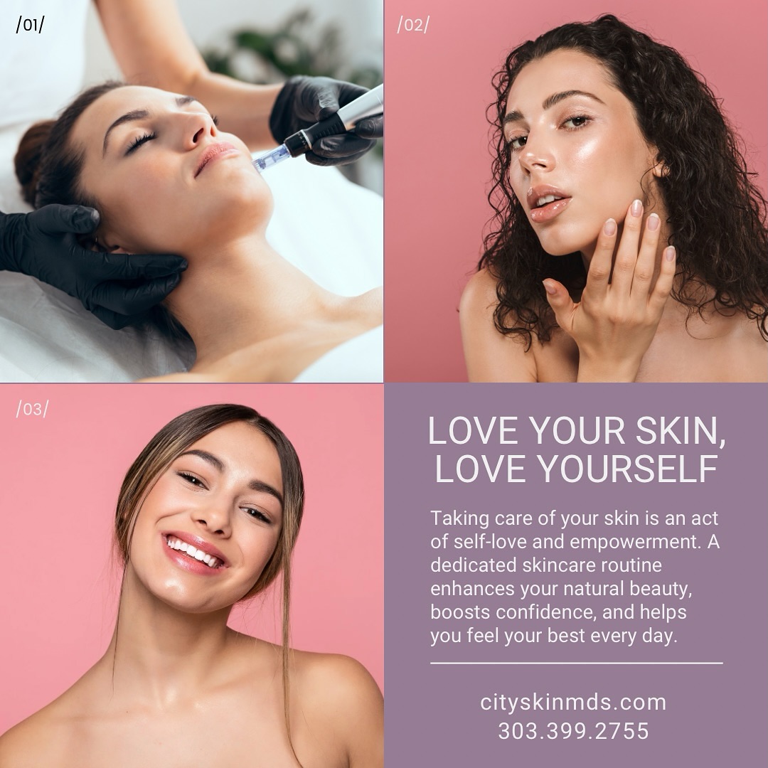 Your skin deserves the best care because loving your skin is loving yourself! ✨ Pamper your natural beauty with treatments tailored just for you.
Boost your confidence, embrace self-love, and glow every single day. 🌸 Ready to transform your skincare journey? Book your appointment now! 💆♀️💖
#LoveYourSkin #SelfCare #SkinCareJourney #NaturalGlow #ConfidenceBoost #HealthySkin #SkinCareGoals #RadiantSkin #SkinCareRoutine #BeautyInsideOut #GlowUp #SkinCareTreatment #SelfLoveMatters #GlowingSkin #BeautyCare #HydratedSkin #SkinTherapy #SkinConfidence #SkinCareTips #SelfCareIsEssential