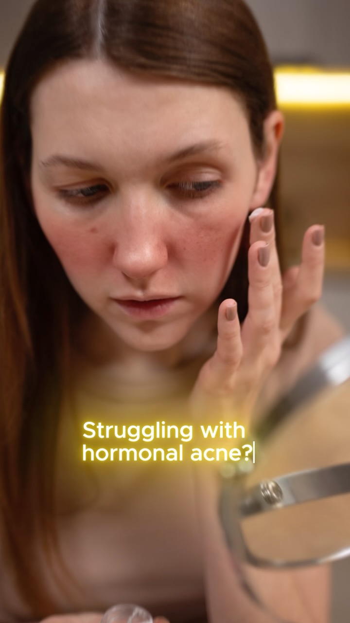 Struggling with hormonal acne? 🌿
Let nature heal your skin and bring back your glow! 💛 Try a turmeric and sandalwood paste for calming relief, and detox with neem water daily. Clear, radiant skin starts with natural care. ✨💧
#HormonalAcne #NaturalSkincare #AyurvedicBeauty #ClearSkinJourney #GlowingSkin #AcneSolutions #AyurvedaForSkin #HolisticHealing #TurmericBenefits #SandalwoodMagic #NeemDetox #ayurbotanics #ayurbotanicsuk #fromnatureforyou