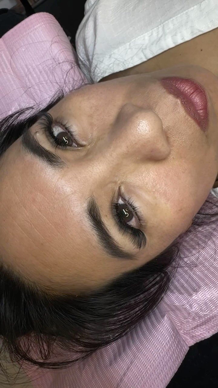 Retention après 4 semaines😮💨
Remplissage on point💜