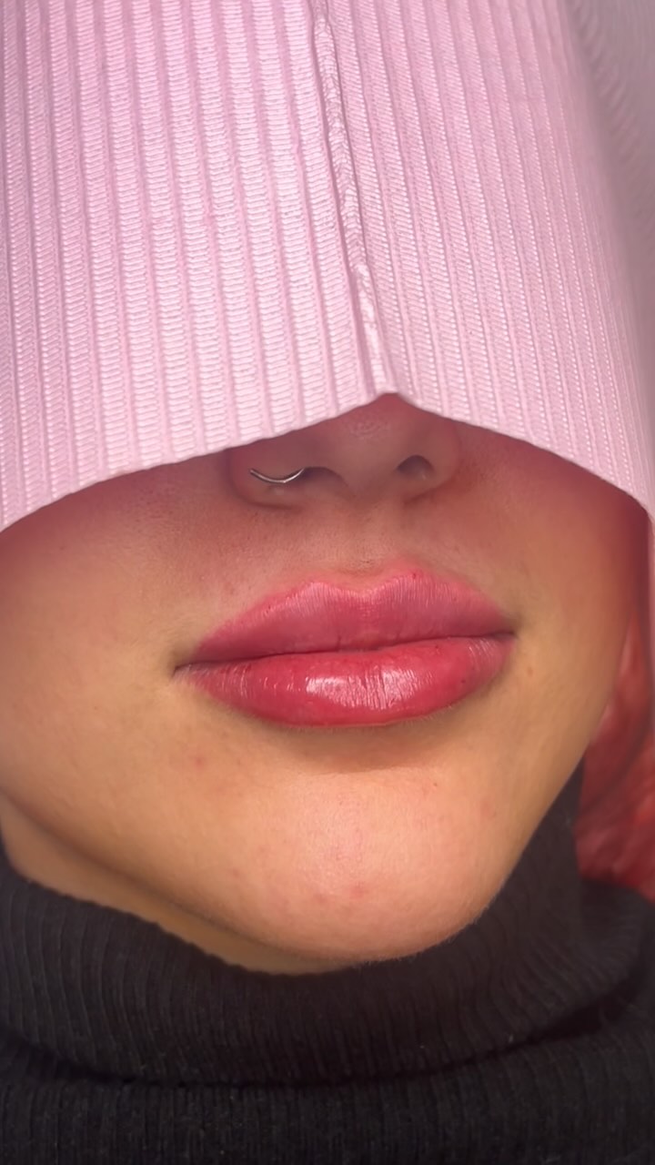 « Les lèvres roses de la femme sont faites pour les baisers et les mots d’amour ».
Russian lips 0.7ML ✨🫦