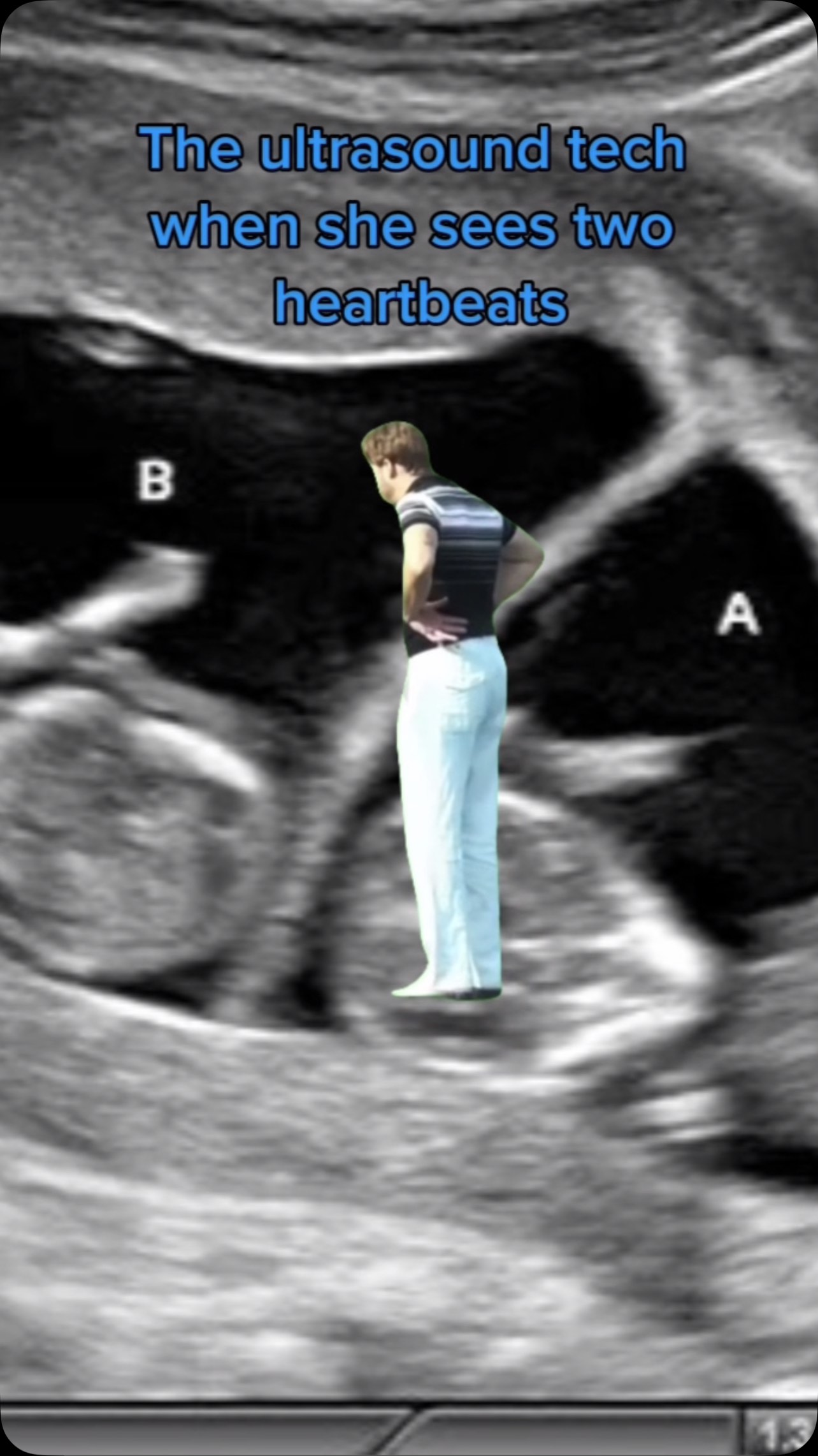 That moment when your life changes forever… 👀👶👶
#TwinMomLife #DoubleTheLove #TwinsOnTheWay #WouldYouLookAtThat #twinstagram #twinsofinstagram #twinningtwice #twins #twinmom