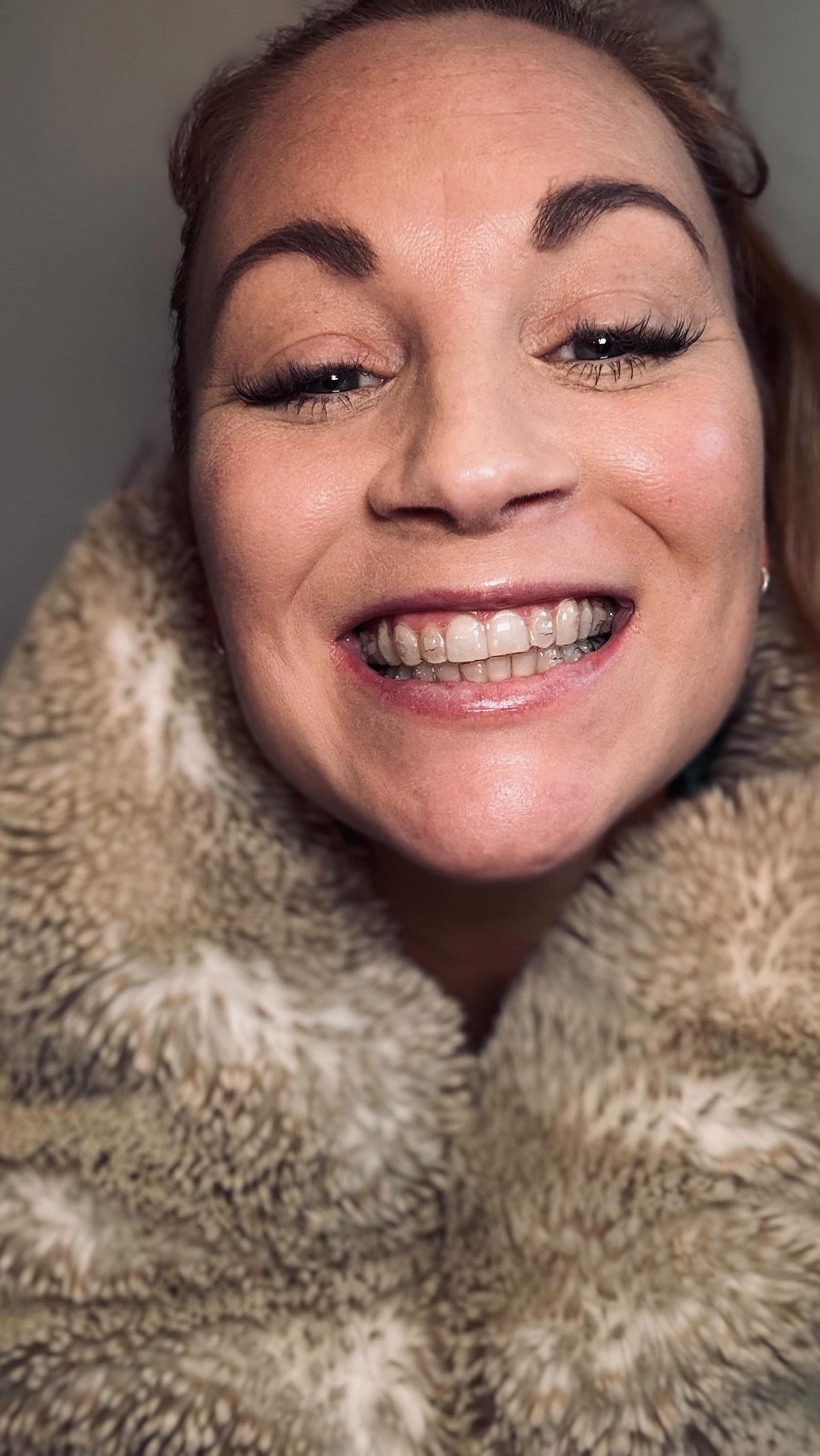 Hey ladies! The holiday fun is over, and it’s time to get back into our routines. Feeling a bit anxious about it? You’re definitely not alone! Here are some tips to help you ease back in:
🫶🏻Acknowledge Your Feelings: It’s totally okay to feel a bit overwhelmed. Give yourself some grace and recognise those emotions.
🥅 Set Small Goals: Start with little tasks to build up your momentum and confidence.
🌅Create a Morning or Evening Ritual: Whether it’s sipping on your favorite tea, a few minutes of meditation, or a quick workout, find something that grounds you.
🧊Stay Hydrated and Rested: Make sure you’re getting enough sleep and drinking plenty of water to keep your energy up.
🙌🏻 Celebrate Small Wins: Every step forward is progress. Celebrate your achievements, no matter how small.
Let’s embrace the new year with positivity and determination!
💪 #BackToRoutine #NewYearNewYou #WomenEmpowerment #CoachingTips