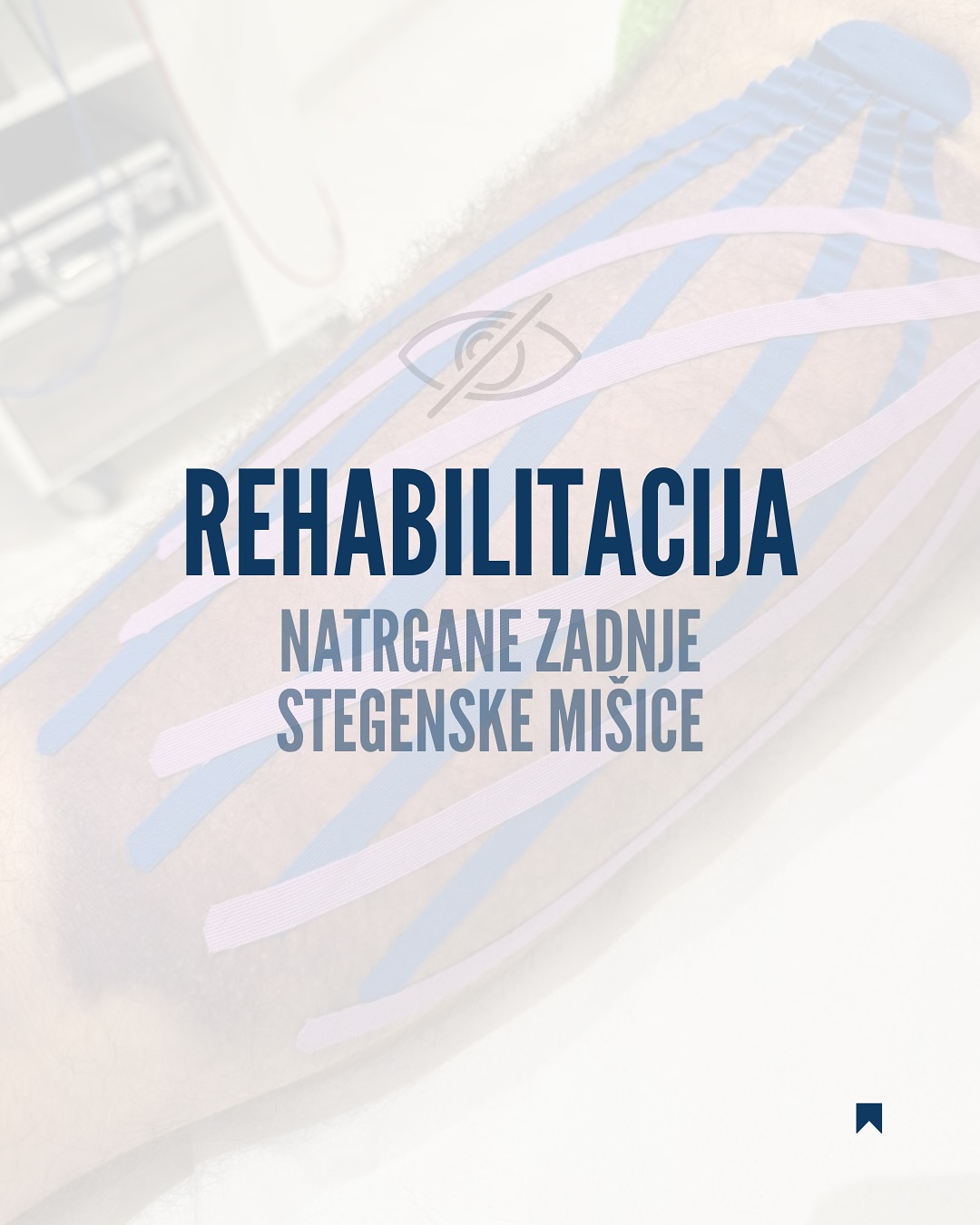 Kineziotaping je lahko odličen pripomoček pri rehabilitaciji poškodb in zmanjšanju bolečin. Danes vam želim pokazati primer, kako lahko ta tehnika pomaga pri zdravljenju natrgane zadnje stegenske mišice.
📸 Na fotografijah vidite, kako je videti poškodovana mišica pred in po uporabi kineziološkega traku. Trak pomaga stabilizirati poškodovano območje, spodbuja prekrvavitev in zmanjša oteklino, kar omogoča hitrejše okrevanje in olajšanje bolečin.
💡 Prednosti koneziotapinga:
- Zmanjša oteklino in hematom
- Sprosti mišično napetost
- Povečuje gibljivost in zmanjšuje bolečino.
- Pomaga pri hitrejšem okrevanju po poškodbah.
- Omogoča, da se nadaljuje s fizičnimi aktivnostmi brez omejitev.
Z uporabo kineziotapinga v kombinaciji z ostalimi fizioterapevtskimi tehnikami in ustreznimi vajami za krepitev poškodovane mišice lahko pospešimo proces rehabilitacije.
💬 Če imate težave s podobnimi poškodbami, se posvetujte s strokovnjakom in ugotovite, kako vam lahko kineziotaping pomaga!
#kineziotaping #rehabilitacija #poškodba #zadnjastegenskamisica #okrevanje #fizioterapija #sasapanic #fiziosasapanic
