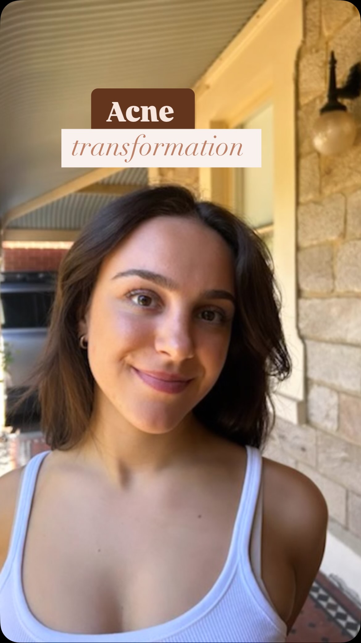 When you understand that skin is a reflection of internal harmony ✨ 6 months of dedicated work with this beauty, and just LOOK at this transformation!
Started with a comprehensive microbiome mapping (because skin struggles often begin in the gut ✨) From there, we crafted a protocol combining specific lymphatic herbs and targeted nutrients - letting her body’s innate healing wisdom do its thing🌿
This is what holistic medicine looks like in action. No quick fixes, just strategic support of the body’s natural processes. Seeing my patients radiate this kind of confidence is literally everything 🦋
Drop ‘nutrient’ below if you’d like to learn about key nutrients for radiant skin!
#AdelaideNaturopath #HolisticAcne #GutSkinConnection #NaturalAcneSolutions #AdelaideSkinHealth”