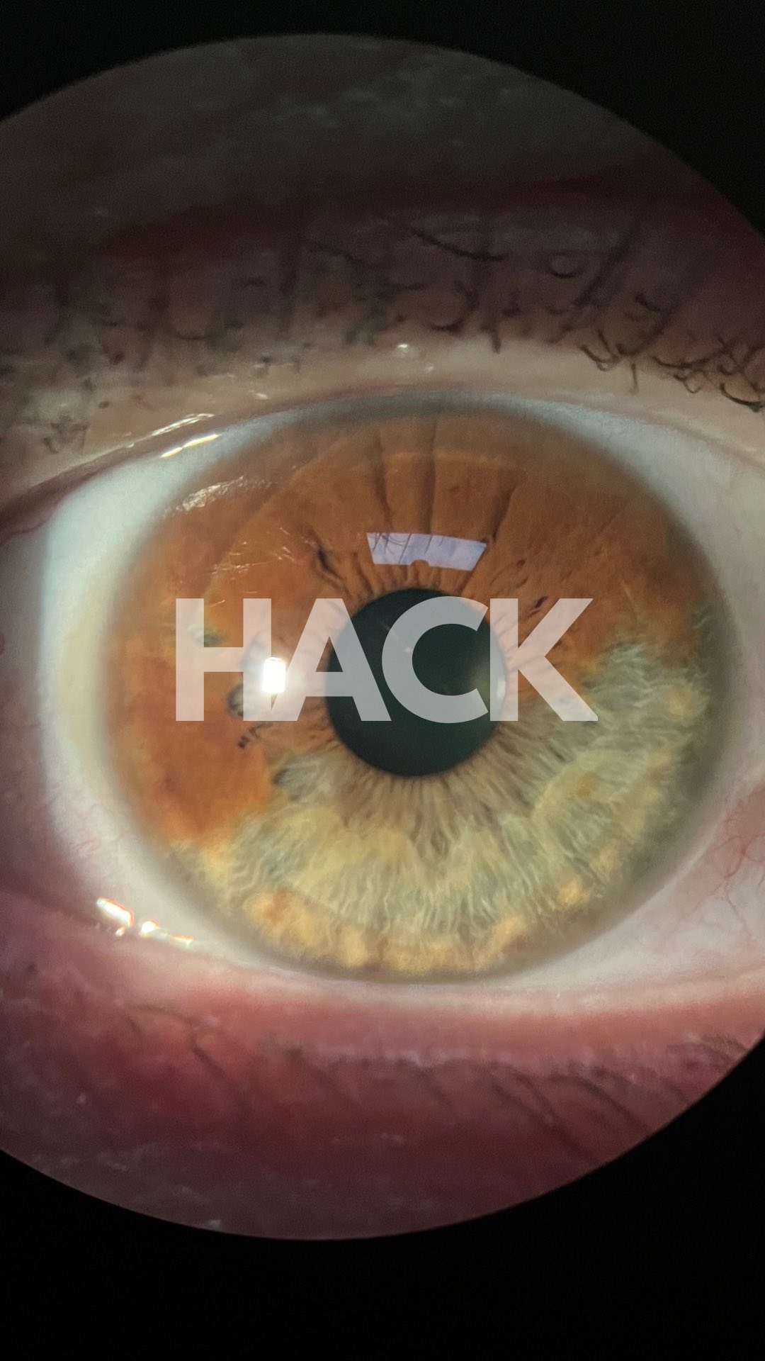 ✨ Ready for an eye care hack? Turn off your phone! 📱➡️❌
These amazing devices help us so much, but your eyes need a break too. Take a moment to look up, soak in the beauty around you, and give your eyes some rest. 🌿
It’ll reduce strain, help prevent nearsightedness, and even improve your posture (no more crouching over that screen)! Your eyes will thank you, and so will your body. 💙👀
#EyeCareTips #ScreenBreak #HealthyVision #DigitalDetox #EyeHealthMatters #VisionCare #WellnessTips #HealthyHabits