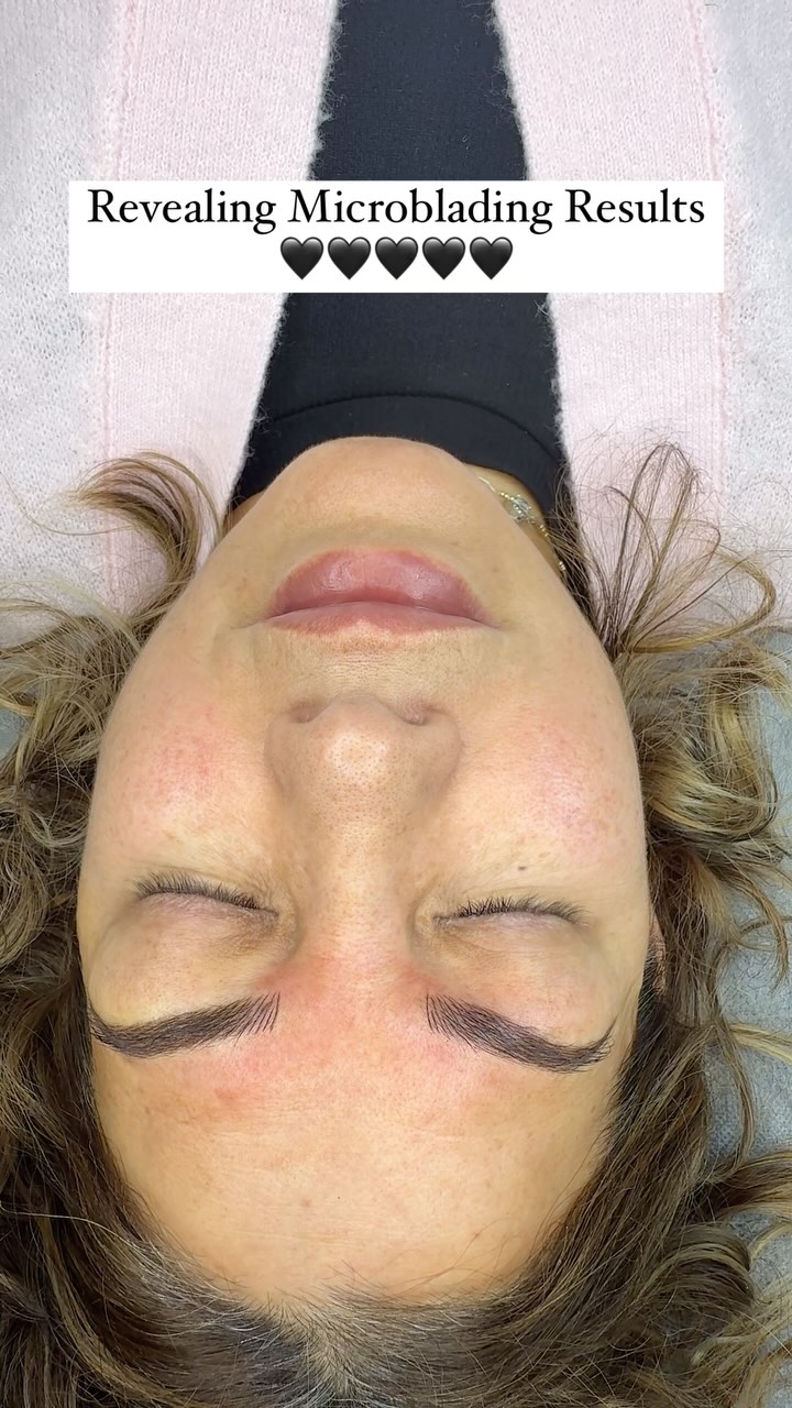 Let’s reveal these brows!
Microblading creates crisp, beautiful looking strokes that image natural hair. If you are worried about the results or if this is the best treatment for you, we welcome you to come for a free consultation and speak to our professional Microblading technician of 9 years.
Click the link in our bio to book your appt or call us at 905-850-5899
#microbladingvaughan #microblading #microbladingwoodbridge #beautytips #eyebrows #brows #skincare