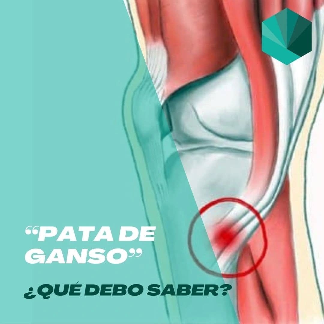 🦵🏻 "PATA DE GANSO" 🪿
¿Sabías que esta estructura puede generar dolor, afectando a muchos deportistas y personas activas? La tendinopatía de la pata de ganso se produce cuando los tendones que se insertan en la parte interna de la rodilla se irritan o degeneran, causando dolor y limitando la actividad. 😣
🔍 Síntomas comunes:
- Dolor en la parte interna de la rodilla
- Sensibilidad al tacto
- Rigidez y limitación del movimiento
💡 ¿Qué puedes hacer?
💪🏻El ejercicio siempre será nuestro mejor aliado para luchar contra las tendinopatías. Existen otras técnicas complementarias como la terapia manual, la neuromodulación o la electrólisis, que nos ayudarán a mejorar la sintomatología. En casos más extremos, puede ser necesaria una cirugía para reparar la zona.
💚 Recuerda, ¡no estás solo en esto! Si sientes molestias, consulta a un fisioterapeuta.
👉🏻 Comparte esta información con alguien que pueda necesitarla y cuida de tus rodillas. ¡Tu cuerpo te lo agradecerá! ✨