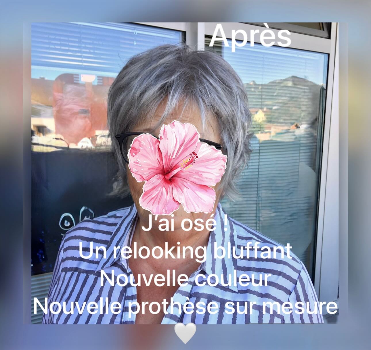 Une nouvelle prothèse capillaire adaptée !
Ma cliente a retrouvé Sa Féminité , Élégante , Rajeunie et Coquine …
#alopecieandrogenetique #pelade #perruque #liguesuissecontrelecancer #liguefribourgeoisecontrelecancer #liguevaudoisecontrelecancer #liguevalaisannecontrelecancer #cheveuxgris