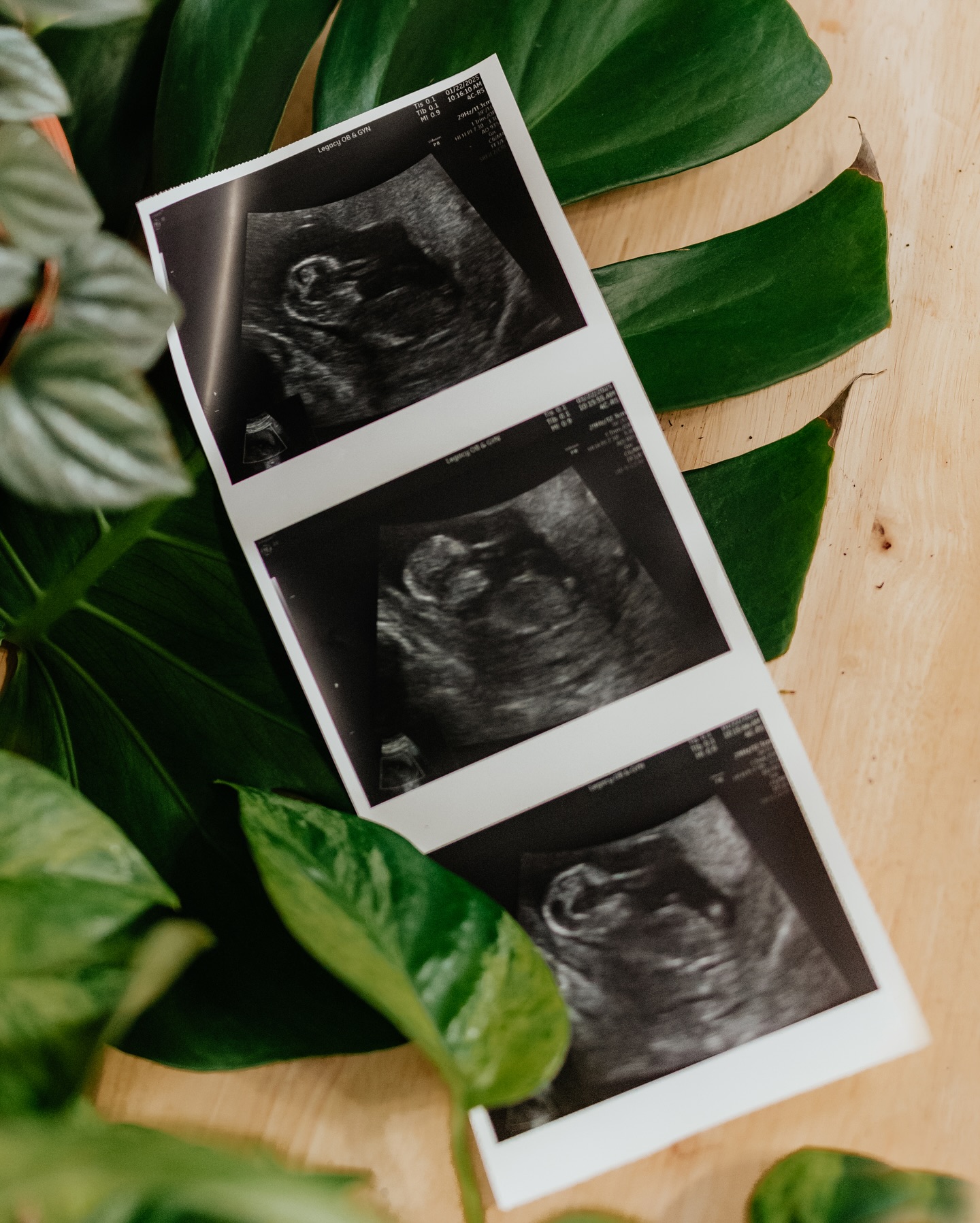 Looks like I will be growing more than just plants this year! 🌱
Baby Ames due August 1, 2025