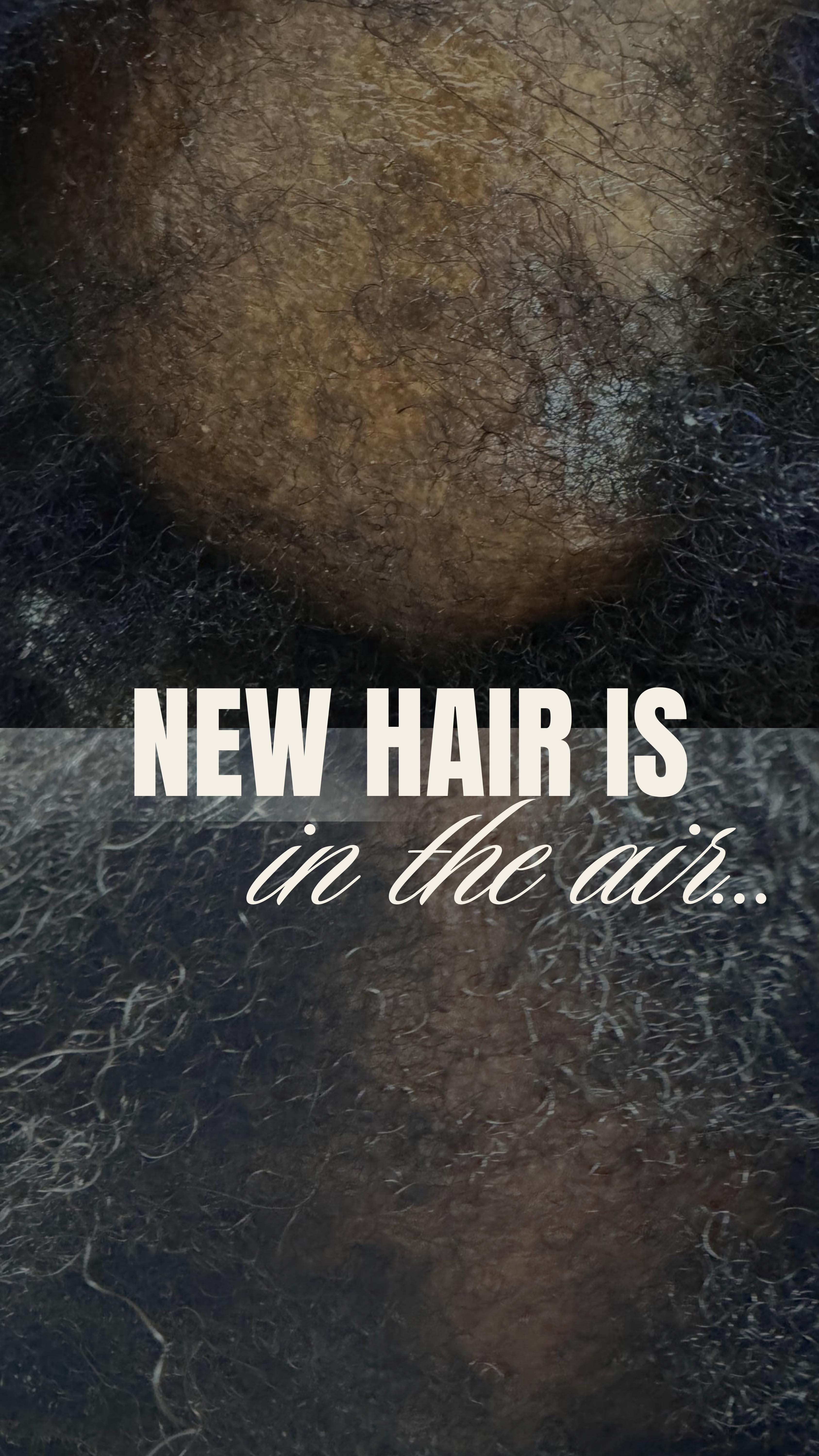 ✨NEW HAIR IS IN THE AIR… AND IT’S HERE TO STAY! ✨
Jarenlang weaves, strakke vlechten, extensions… of gewoon stress – het eist zijn tol. Kale plekken, een terugtrekkende haarlijn, dunner wordend haar… en dan die onzekerheid bij elke blik in de spiegel.
MAAR herstel is mogelijk. 🤩 Onze Hair Recovery Therapy werkt diep in de hoofdhuid om haarzakjes te activeren, haaruitval te verminderen en nieuwe groei te stimuleren.
Swipe voor de transformatie – WOW! ✨ Dit is wat wetenschap + expertise kan doen.
✅ Herstelt haaruitval door styling & stress
✅ Stimuleert nieuwe haargroei op dunne plekken
✅ Geschikt voor alle huidtinten en haartypes
Je haar verdient deze comeback. Boek nu jouw Micro & Meso Hair sessie via thehagueclinic.nl