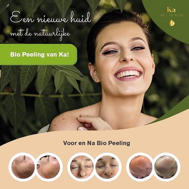 ✨ Holistic Beauty Treatment met Biopeeling van KA Skinformular ✨
Op zoek naar een behandeling die jouw huid laat stralen én zorgt voor innerlijke rust? Tijdens mijn 75- of 90-minuten Holistic Beauty Treatment werk ik met de krachtige Biopeeling van KA Skinformular – een prachtig product ontwikkeld met passie, kennis en kunde.
🌿 Waarom deze biopeeling zo bijzonder is:
✅ 100% biologisch en huidvriendelijk
✅ Stimuleert natuurlijke huidvernieuwing zonder irritatie
✅ Zorgt voor een stralende, egale en frisse huid
Of je nu kiest voor 75 of 90 minuten, je ervaart een combinatie van huidverbetering, ontspanning én holistische verzorging.
✨ Stralend van binnen én van buiten. ✨
#HolisticBeauty #Biopeeling #KASkinformular #NatuurlijkeGlow #Huidverbetering #InnerlijkeBalans #stralendehuid