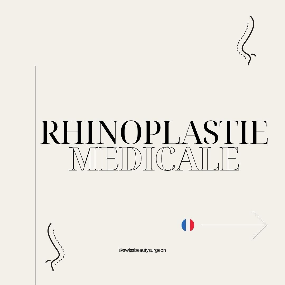 👃La Rhinoplastie Médicale : Sublimez Votre Nez Sans Chirurgie 👃
Vous rêvez d’affiner ou de corriger certains aspects de votre nez sans passer par la chirurgie ?
La rhinoplastie médicale est une solution rapide, non invasive et efficace pour remodeler votre nez à l’aide d’injections d’acide hyaluronique.
🤔 Qu’est-ce que la rhinoplastie médicale ?
Il s’agit d’une technique esthétique qui permet de corriger les petites imperfections du nez :
• Atténuer une bosse nasale,
• Combler un creux,
• Rehausser la pointe du nez,
• Harmoniser la symétrie globale.
✨Les avantages de cette technique✨:
• Résultats immédiats,
• Sans douleur (grâce à l’utilisation d’un produit contenant un anesthésiant),
• Aucun temps de récupération : retour à vos activités dès la fin de la séance,
• Résultats réversibles et ajustables.
🫣Pour qui ?
Cette méthode convient à celles et ceux qui souhaitent une amélioration subtile et naturelle, sans les contraintes d’une intervention chirurgicale.
👉Chez Swissbeautysurgeon, nous privilégions une approche personnalisée pour révéler le meilleur de votre profil, en respectant l’équilibre et les proportions de votre visage.
✨ Envie d’en savoir plus ? Prenez rendez-vous dès aujourd’hui pour une consultation et découvrez comment la rhinoplastie médicale peut transformer votre visage en douceur.
📩Contactez-nous par message privé pour réserver votre créneau !
#rhinoplastiemedicale #acidehyaluronique #MédecineEsthétique #beauténaturelle #drveber